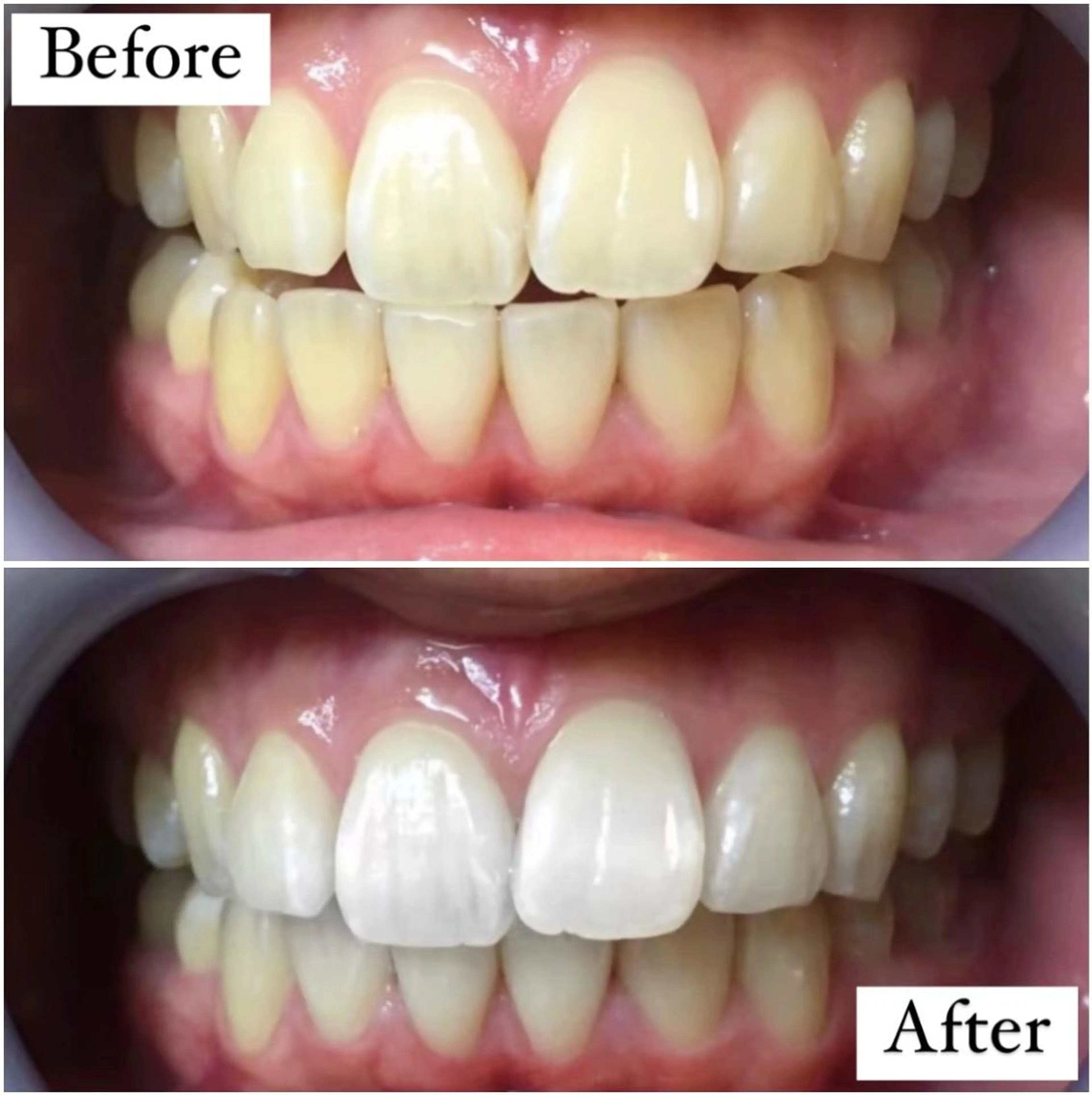 その他 LBSホワイトニング 銀座店💎スタッフ峯のその他イメージ