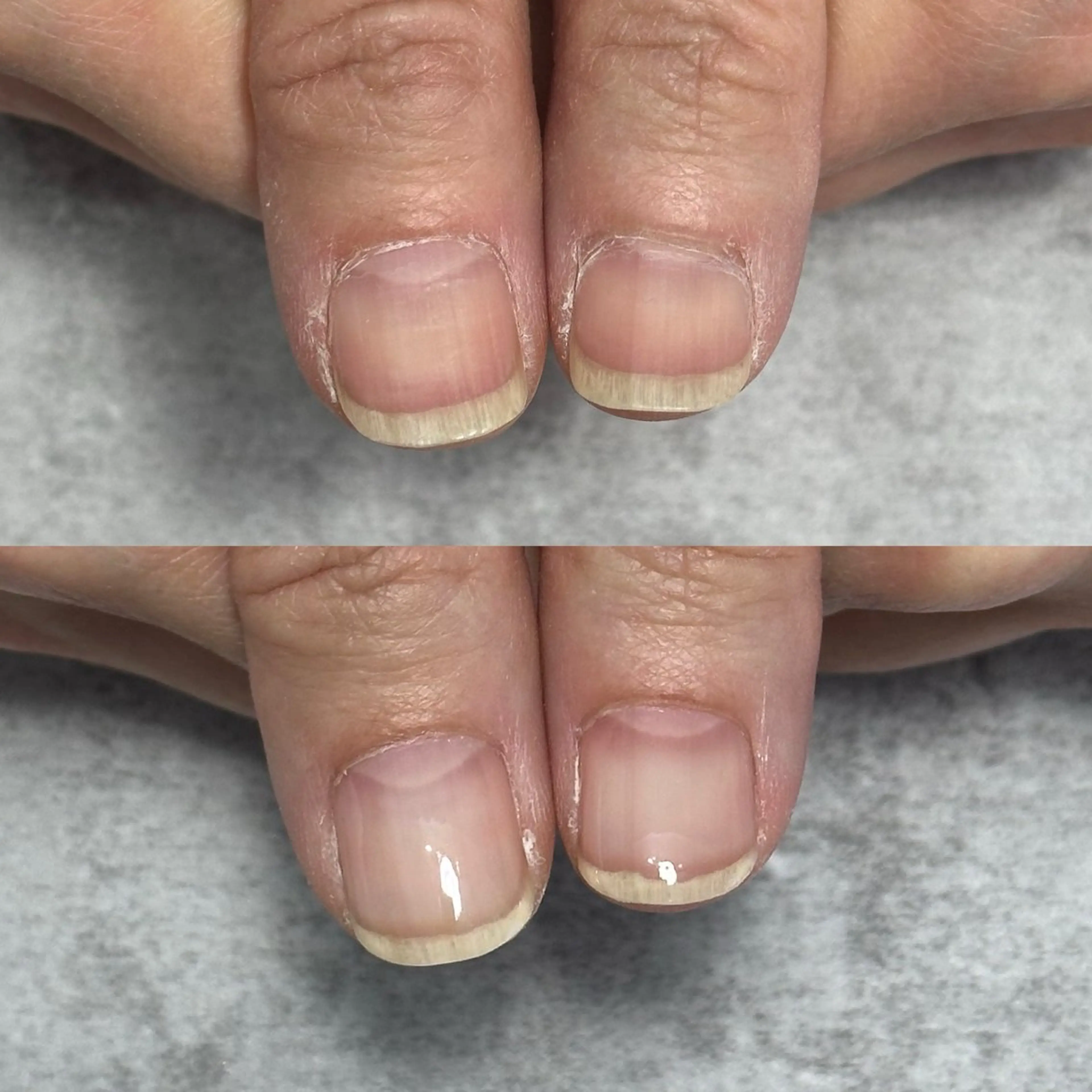 ネイル 埼玉県ちび爪専門店｜ 自爪育成｜朝霞市のネイルデザイン