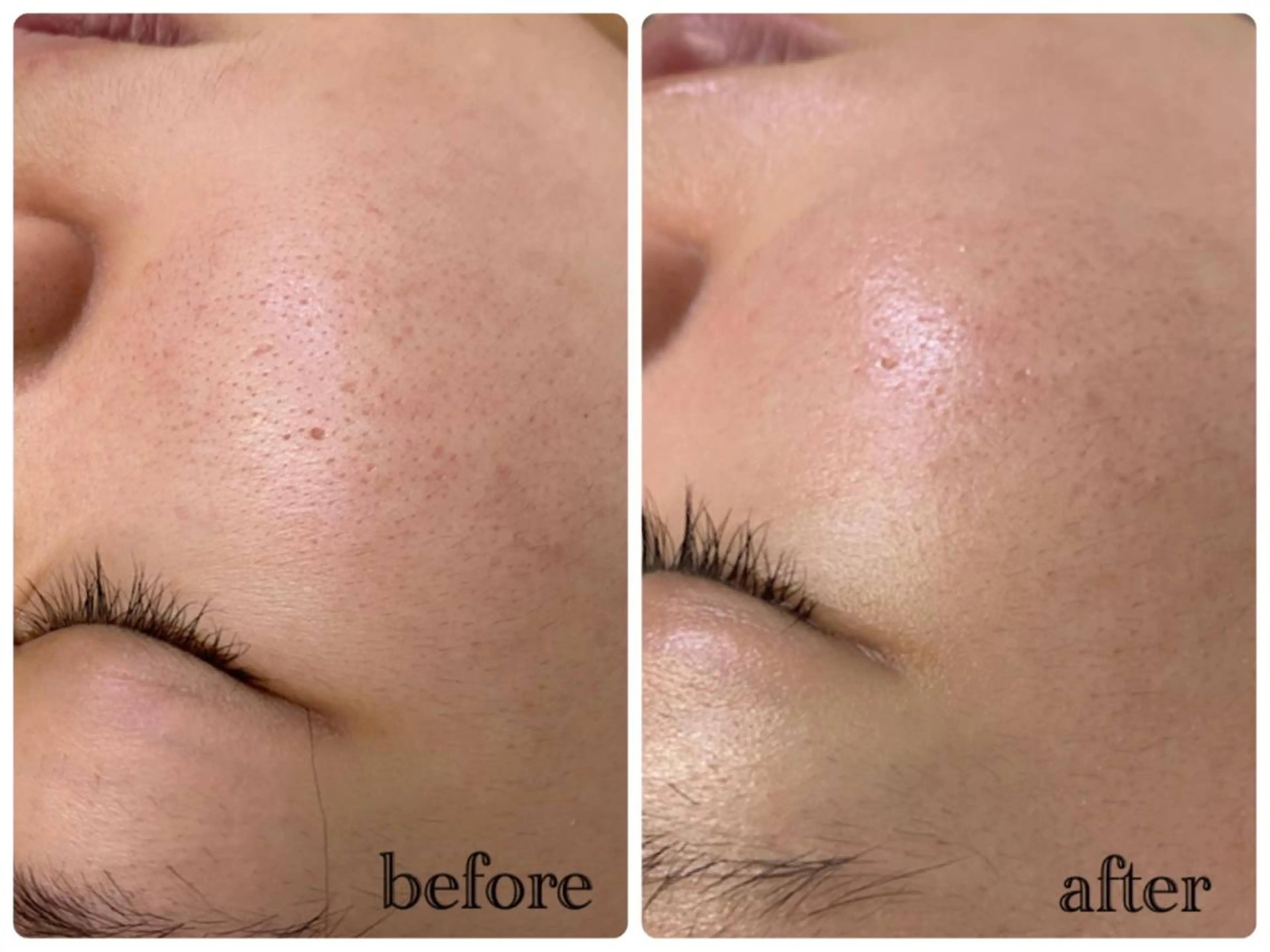 デ・アイム新潟北所属・サイトウ .のエステ・リラクイメージ