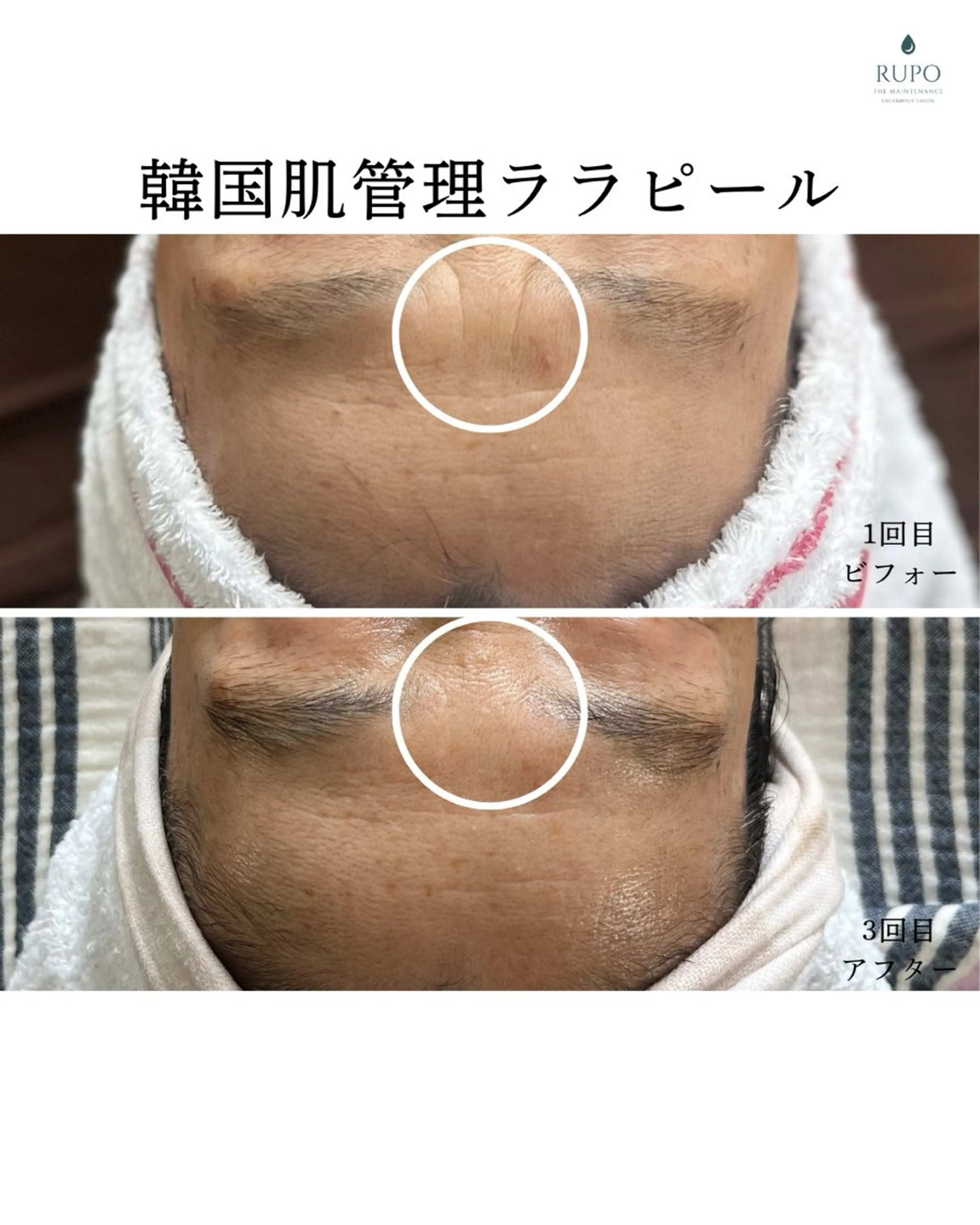 エステ 医療提携認定サロン　RUPO THE MAINTENANCE新潟店【ローマピンク/ララピール】所属・オーナー Nanjoのエステ・リラクイメージ