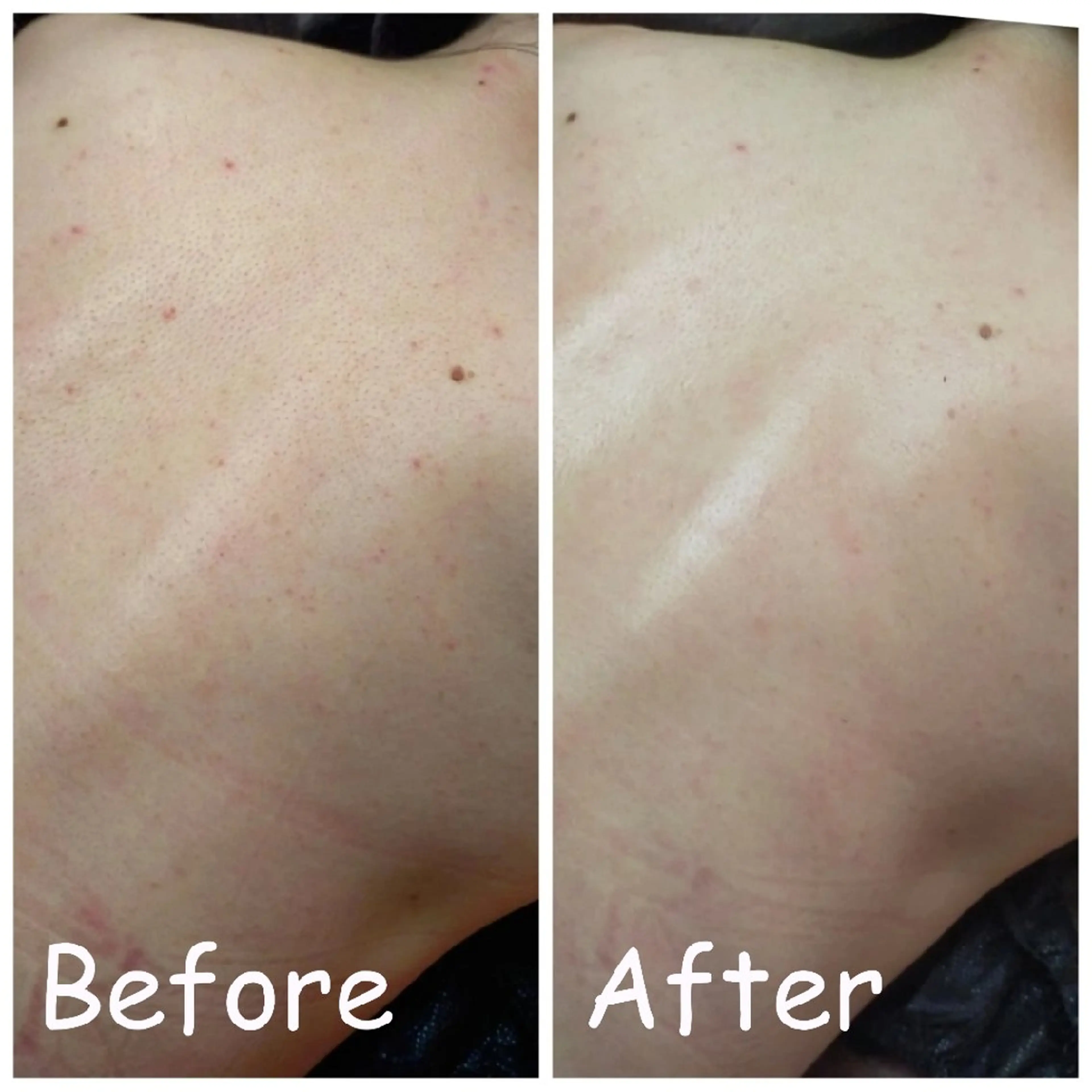 その他 小顔艶肌＆痩身サロン 🍋 Meguのエステ・リラクイメージ