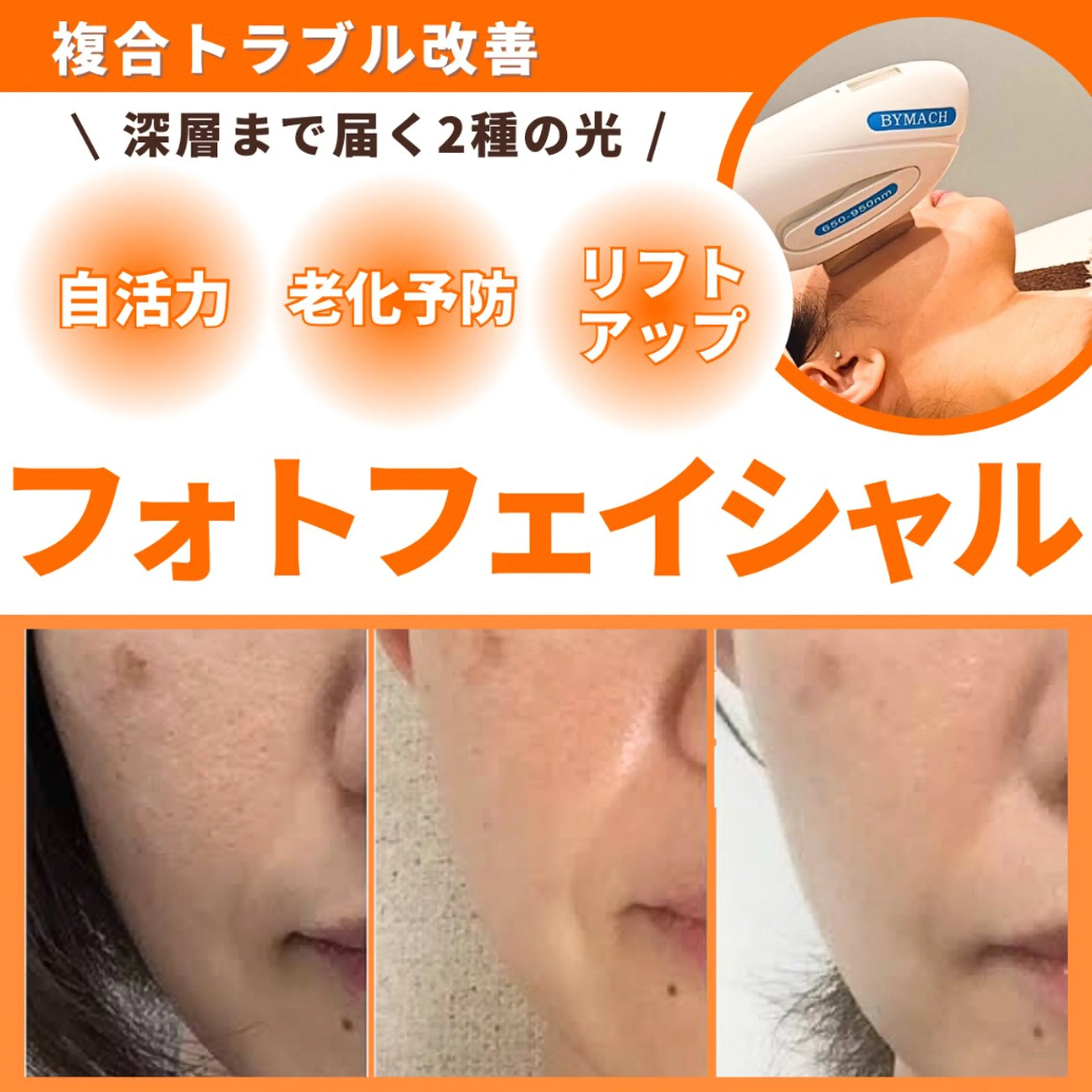 エステ エステサロン JURISのエステ・リラクイメージ