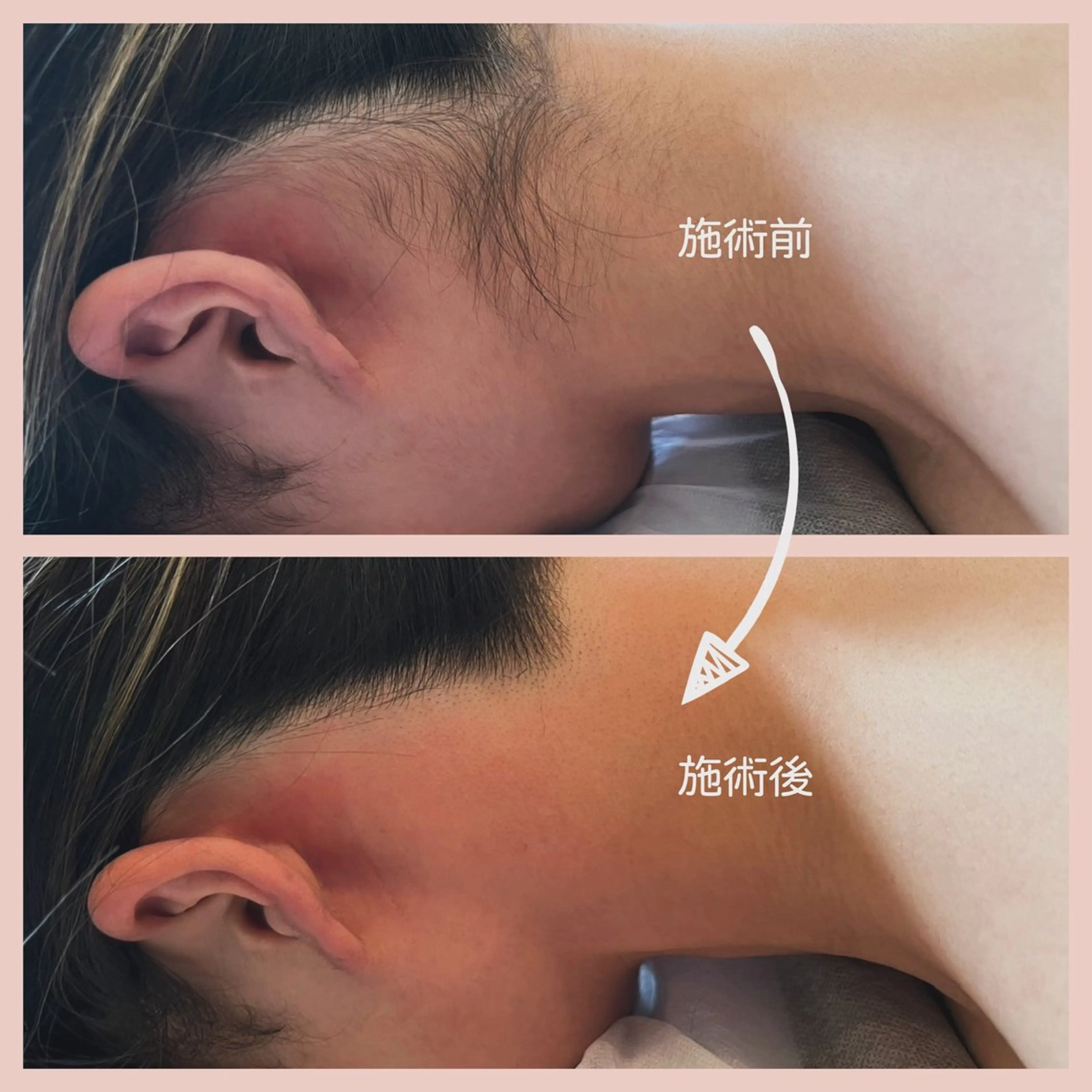 private脱毛salon HALE所属・private脱毛 salon HALEのエステ・リラクイメージ