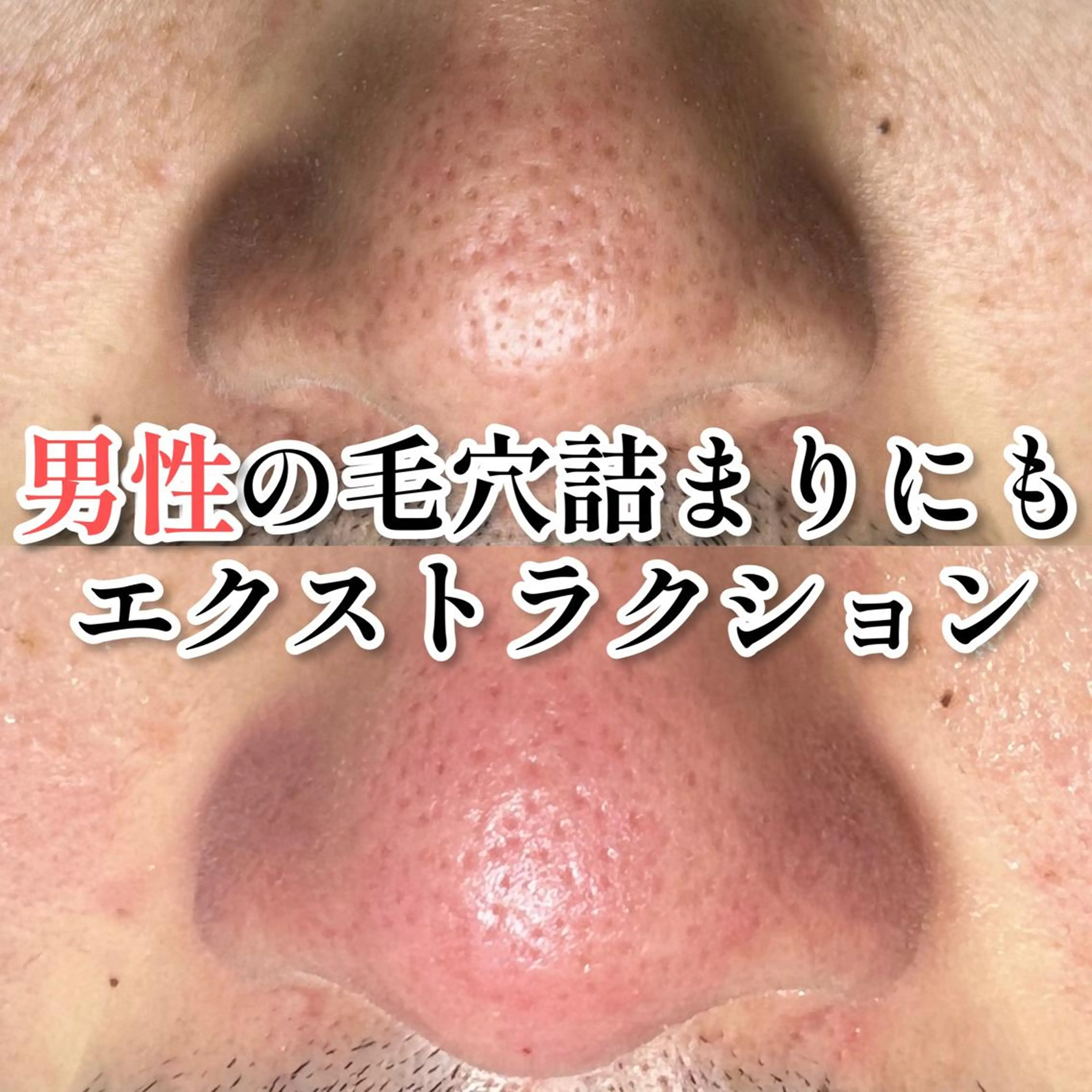 エステ しおや ともこのエステ・リラクイメージ