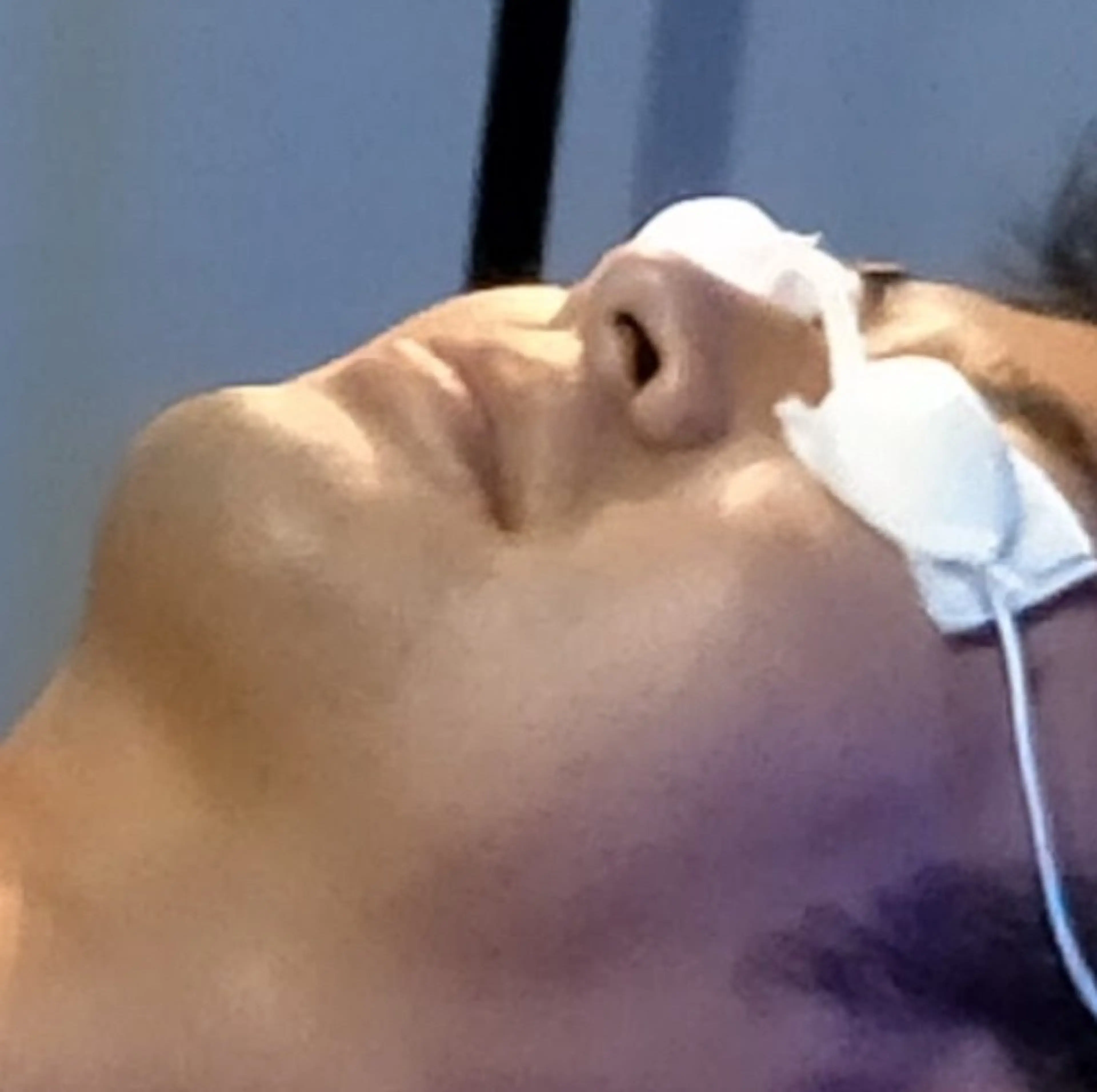 【学生/期間/人数限定】掲載記念　髭脱毛全箇所or VIO全箇所セットの写真