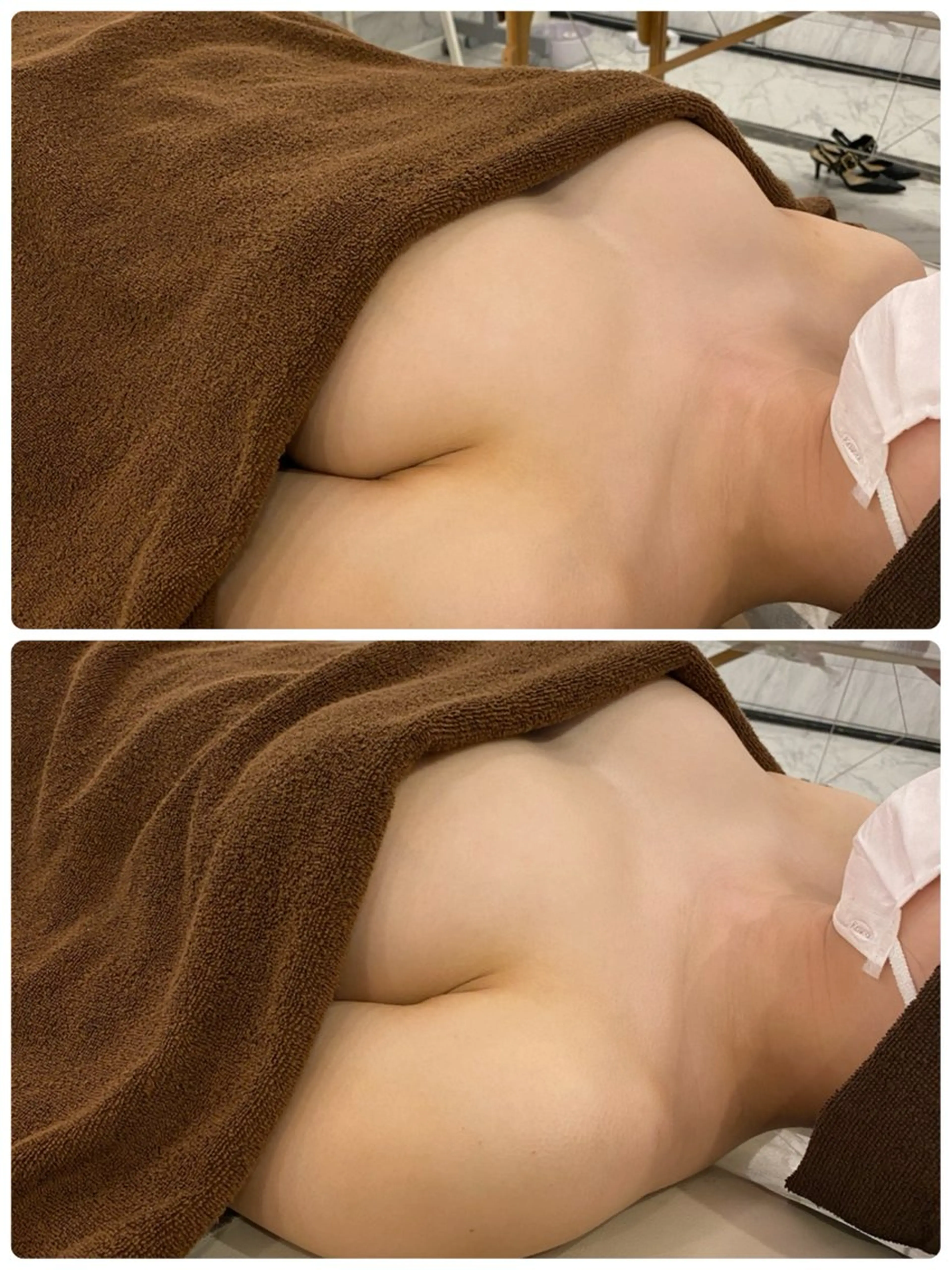 【ふっくらバスト＆すっきり小顔】美乳美顔施術 ¥30,000→¥11,600の写真