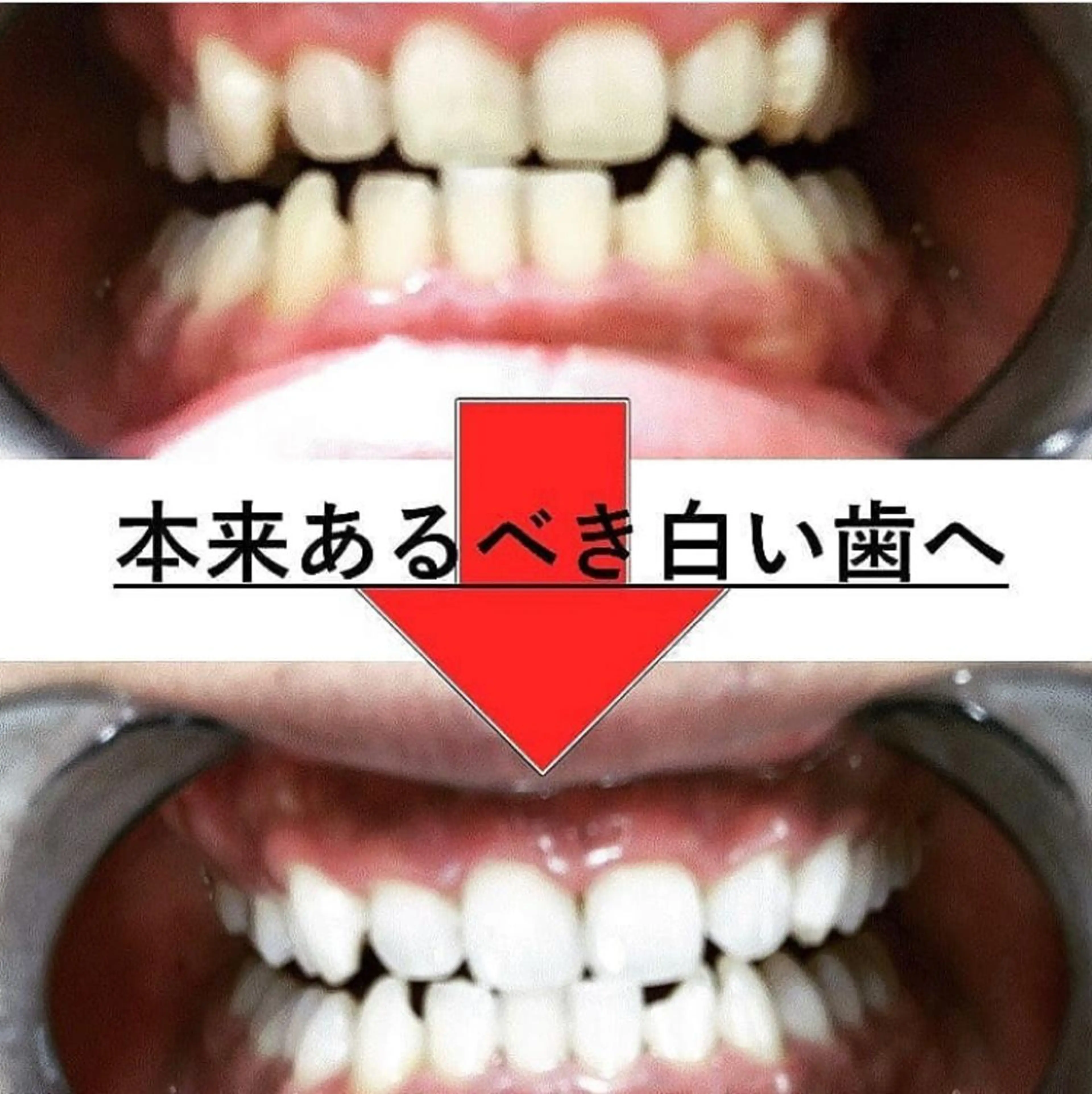 その他 ホワイトニングサロン nico西葛西店のその他イメージ