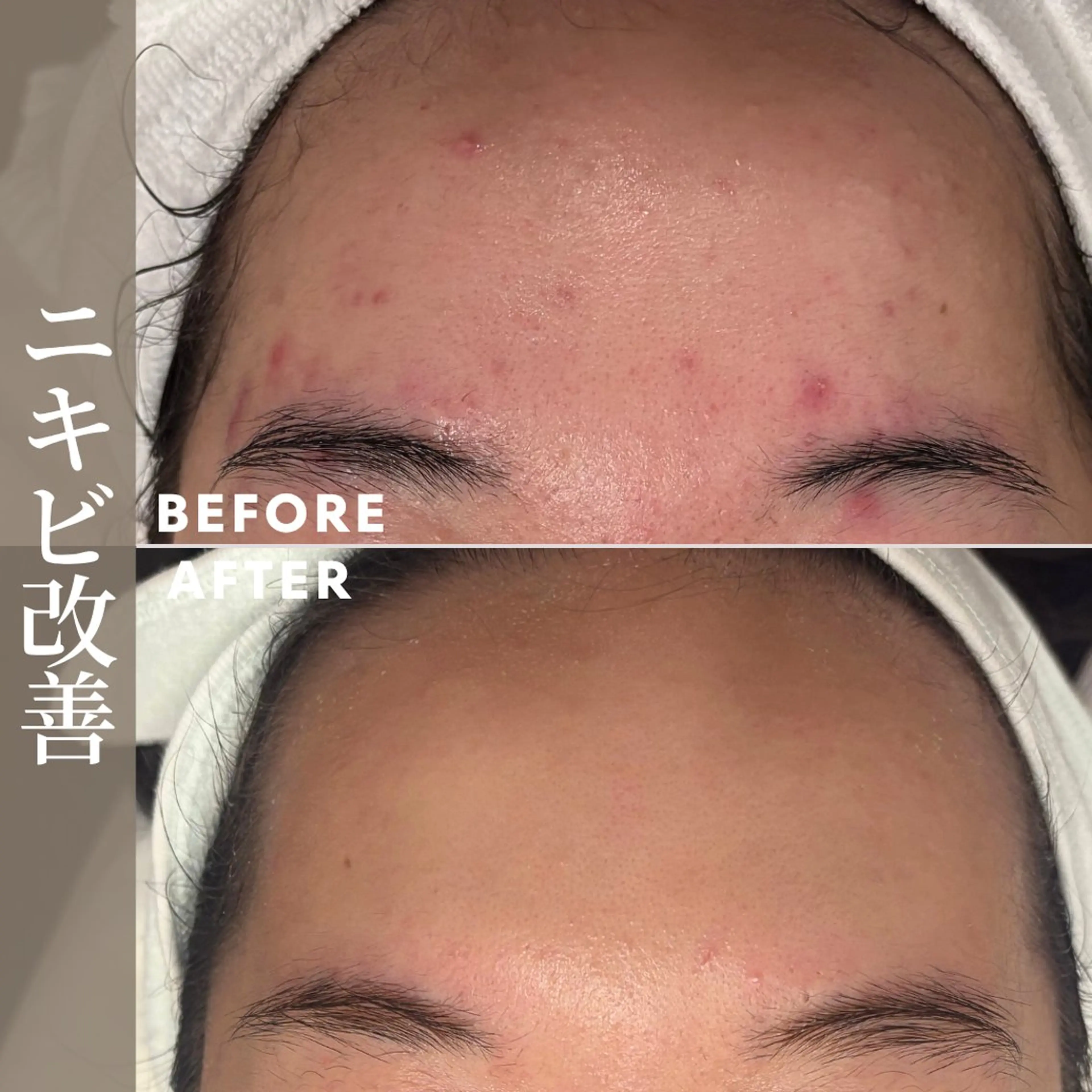 エステ 肌育成サロン ♡ 村田理紗のエステ・リラクイメージ