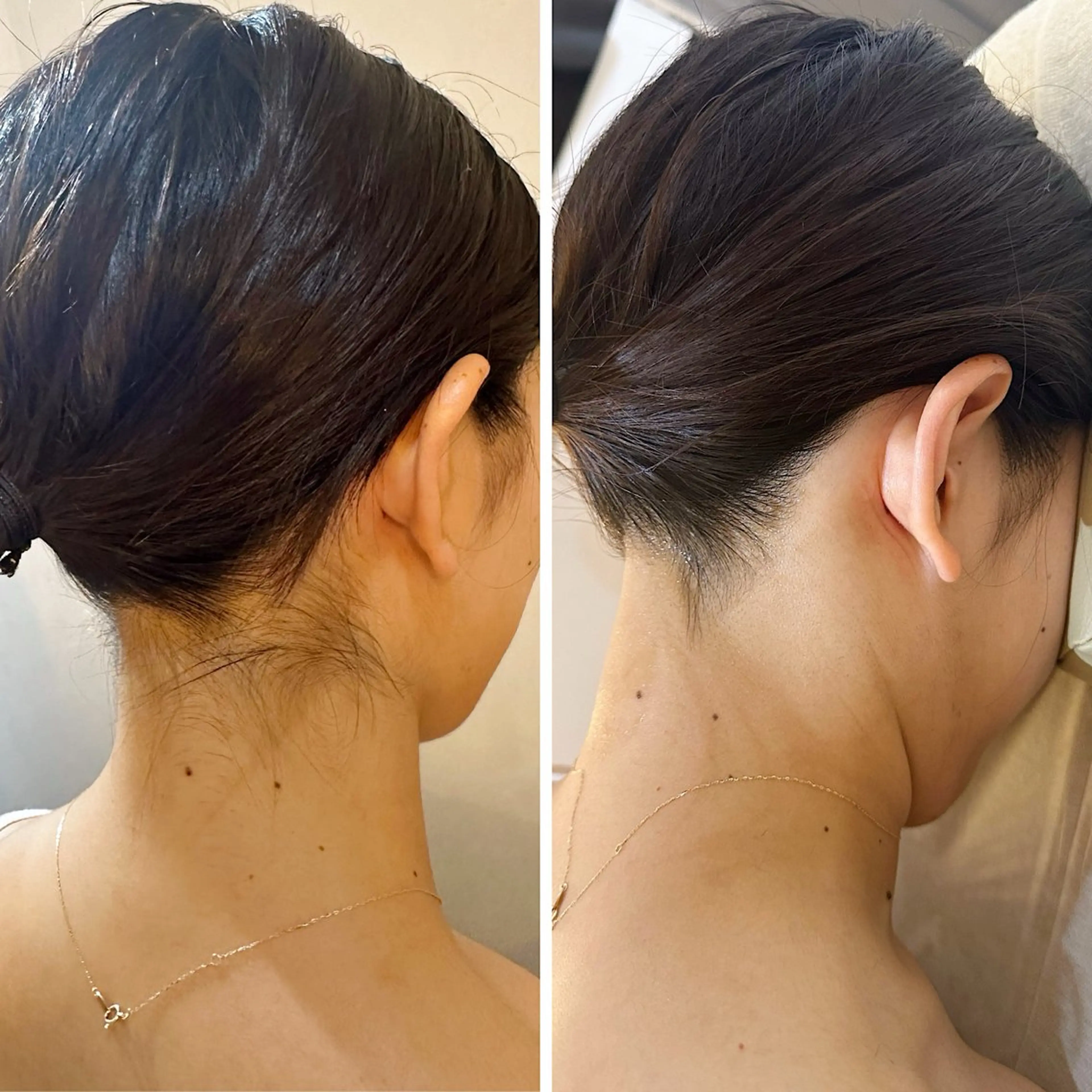 脱毛 うなじ脱毛/美肌脱毛 LABELのエステ・リラクイメージ