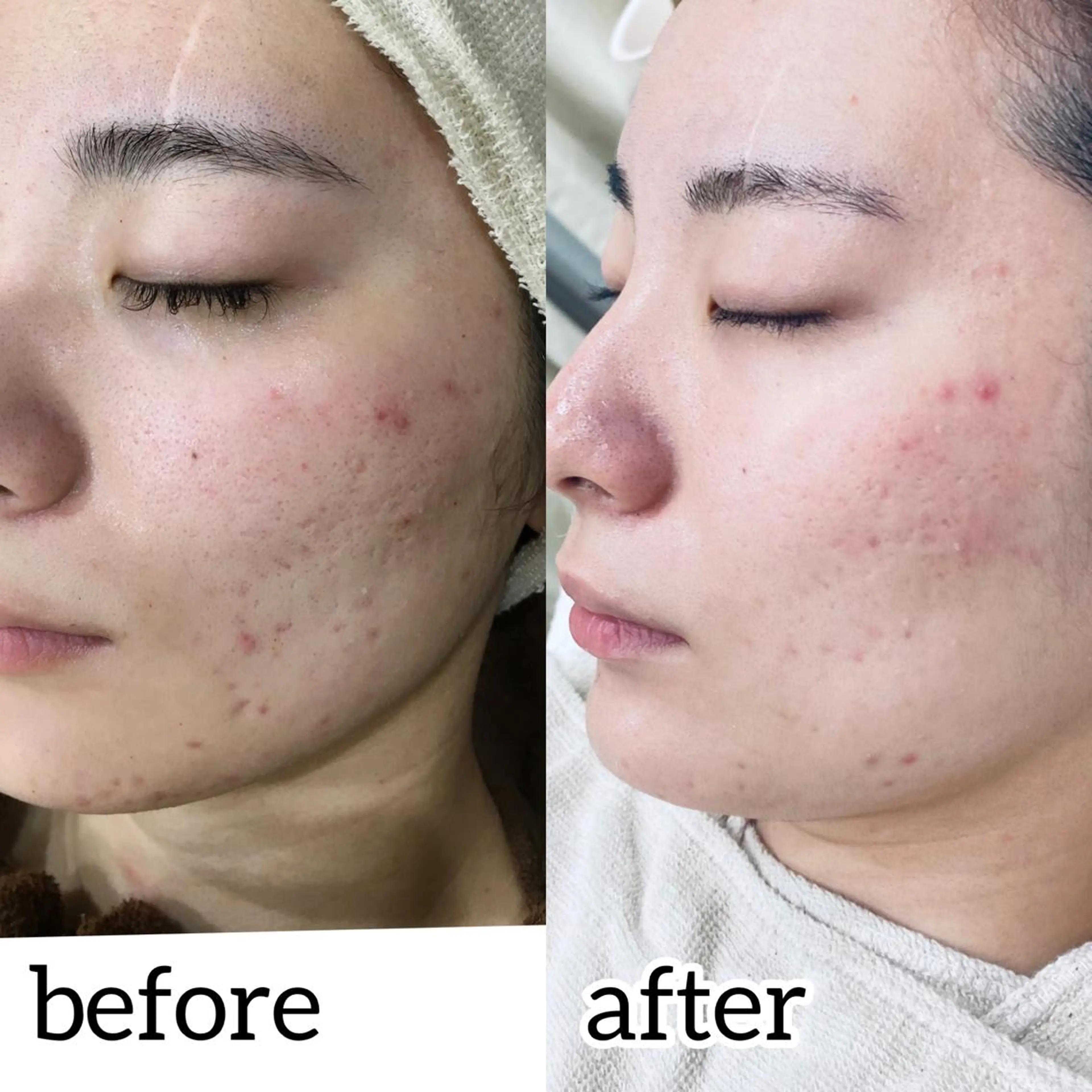 laluna saki...のその他イメージ