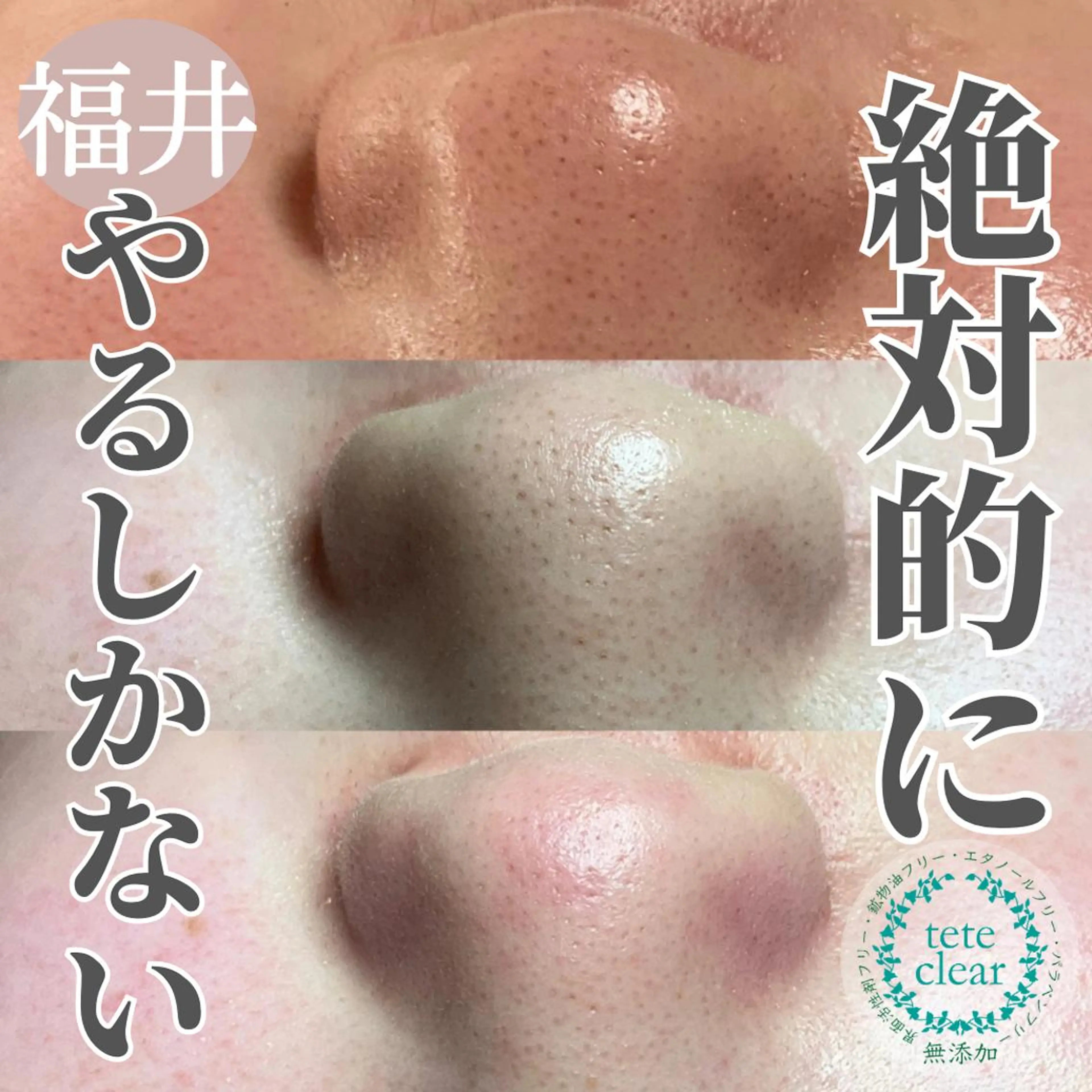 毛穴ケア専門サロン Yourmeユアミーのエステ・リラクイメージ