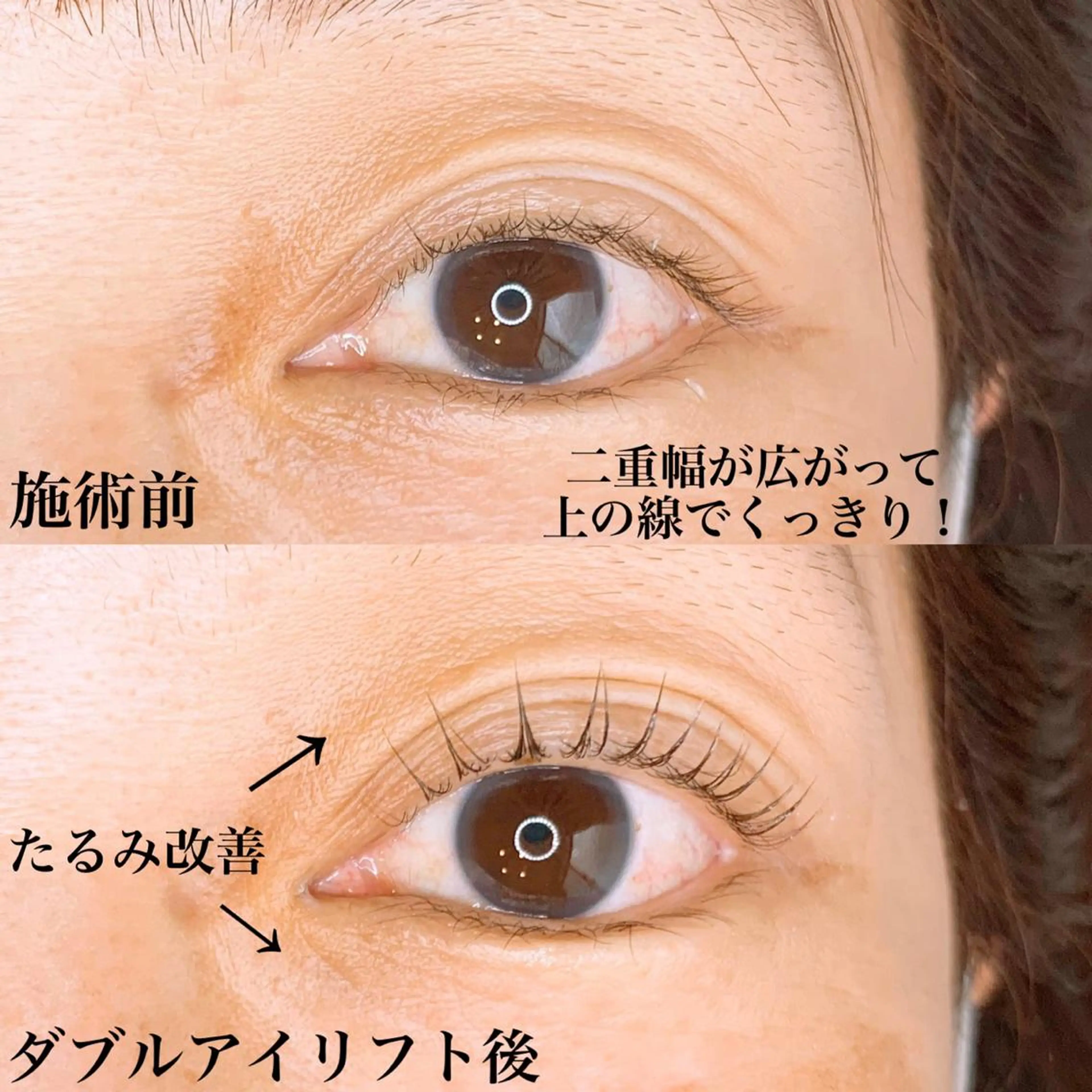 パーマ メンズ マツエク・マツパ マツパ アイラッシュサロン CoCoのエステ・リラクイメージ