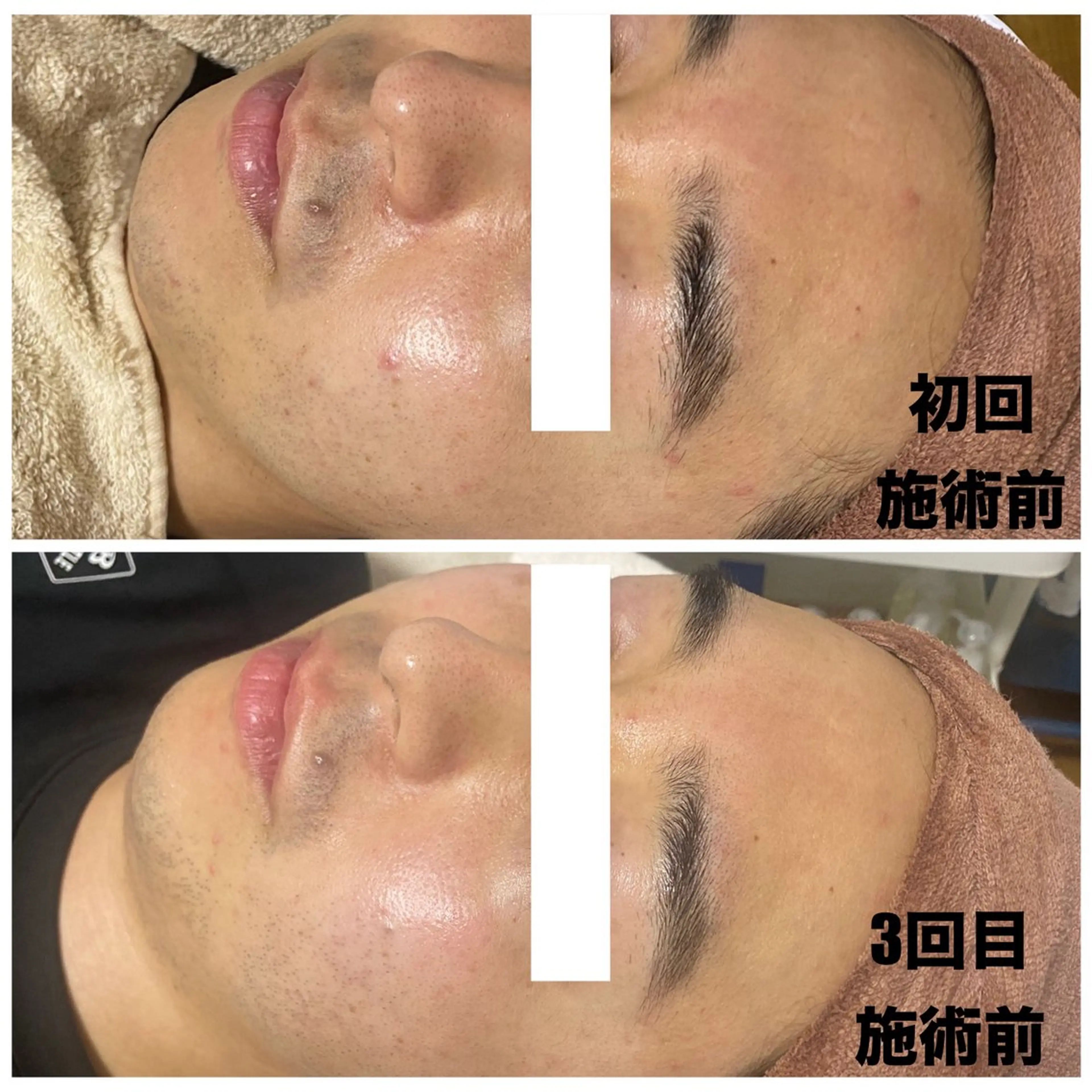 メンズ エステ Linoa所属・Linoa(リノア) エステ&リラクのエステ・リラクイメージ