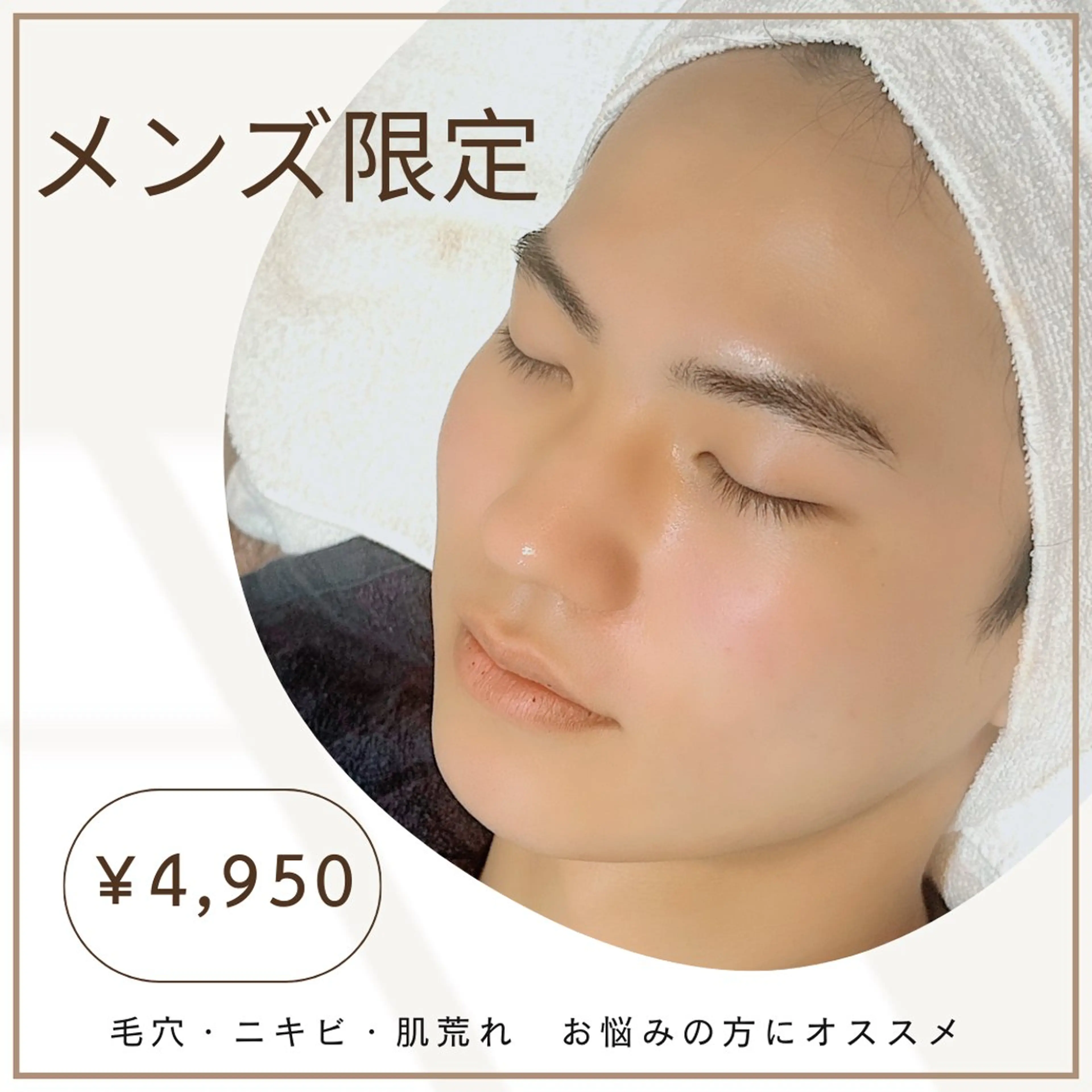 【学割U24/メンズ限定】毛穴洗浄＋炭酸泡パック＆ピーリング30分ケア￥4,950/毛穴・ニキビ・肌荒れに◎の写真