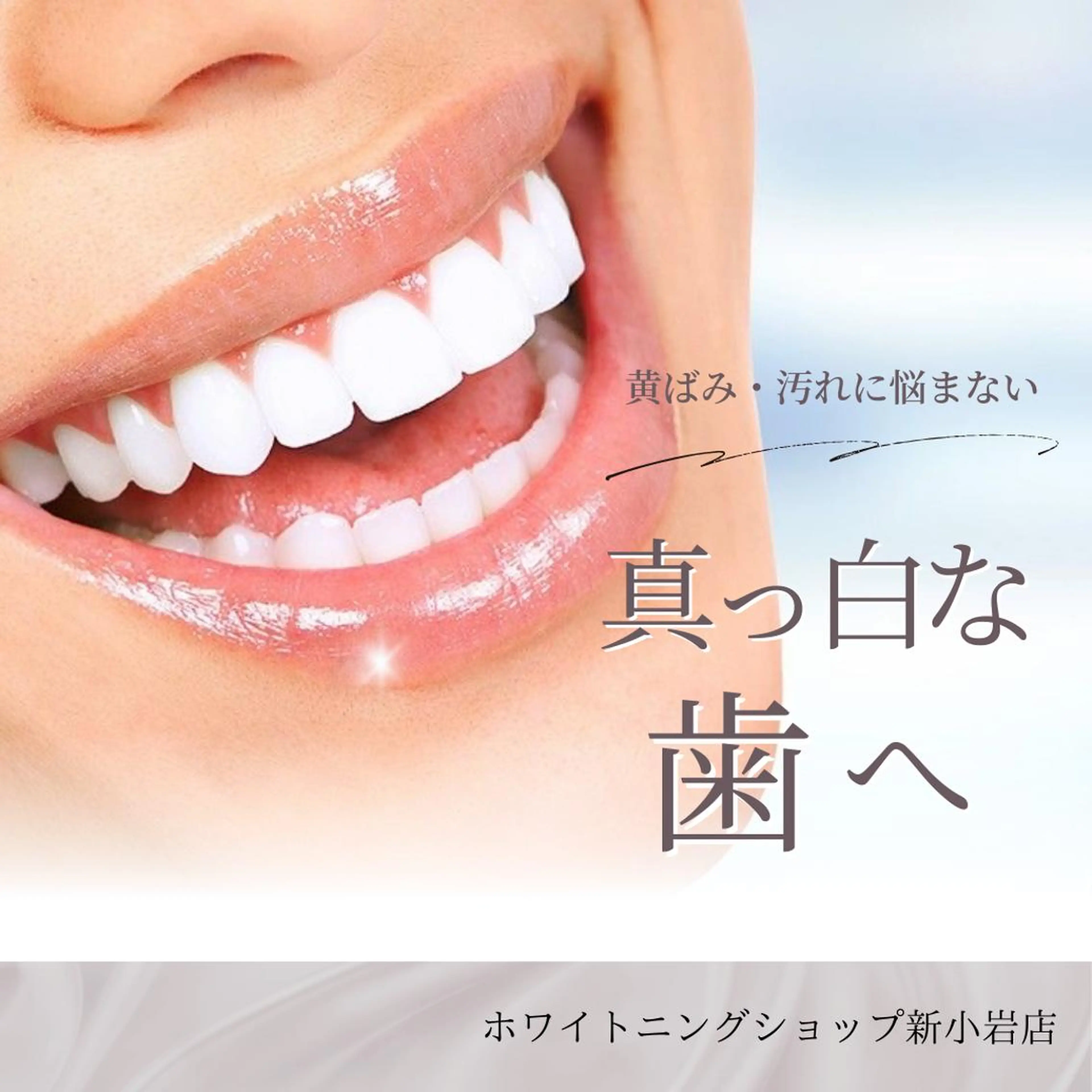 メンズ その他 ホワイトニング ショップ新小岩店のその他イメージ