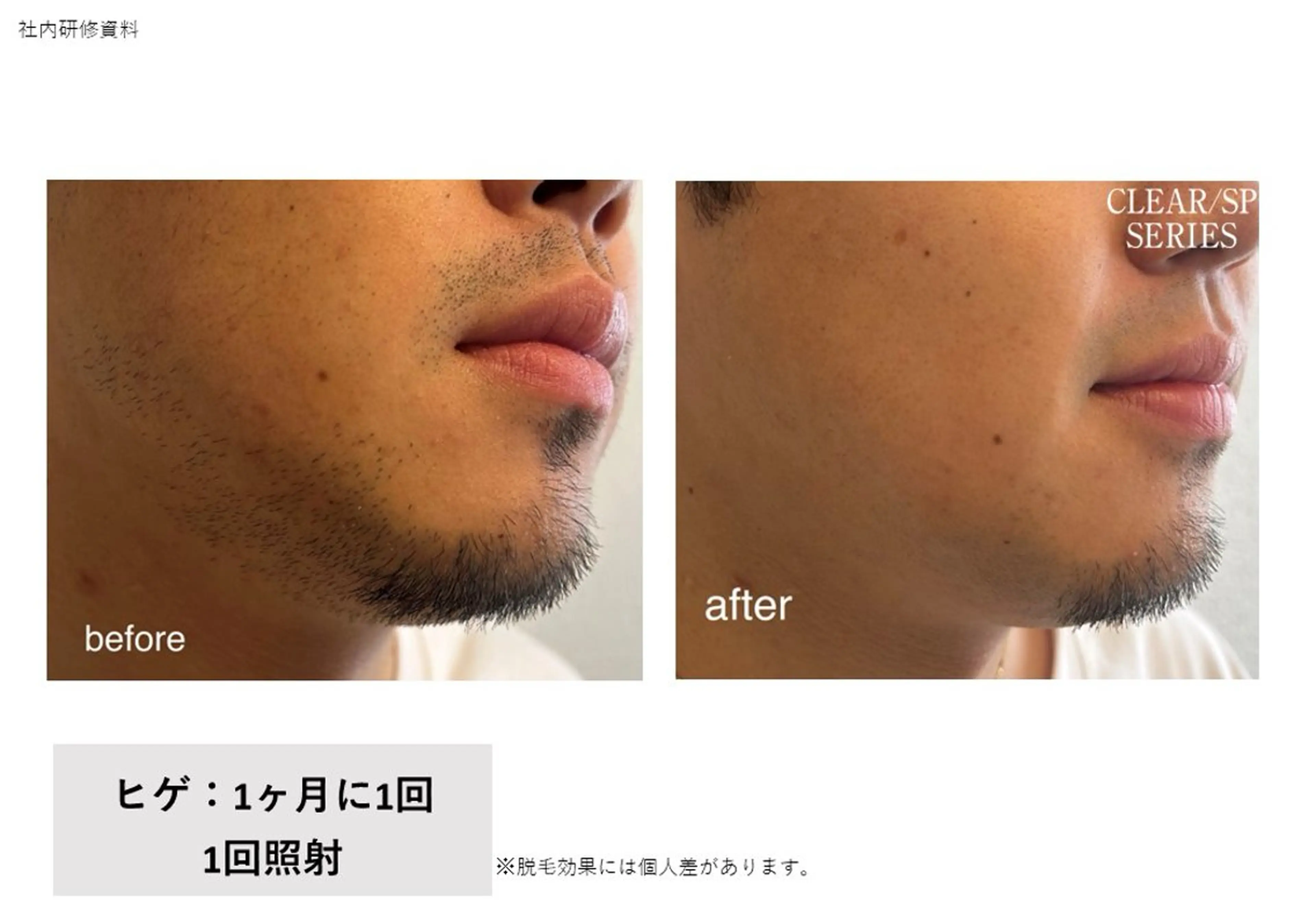 VIERU YURIのネイルデザイン