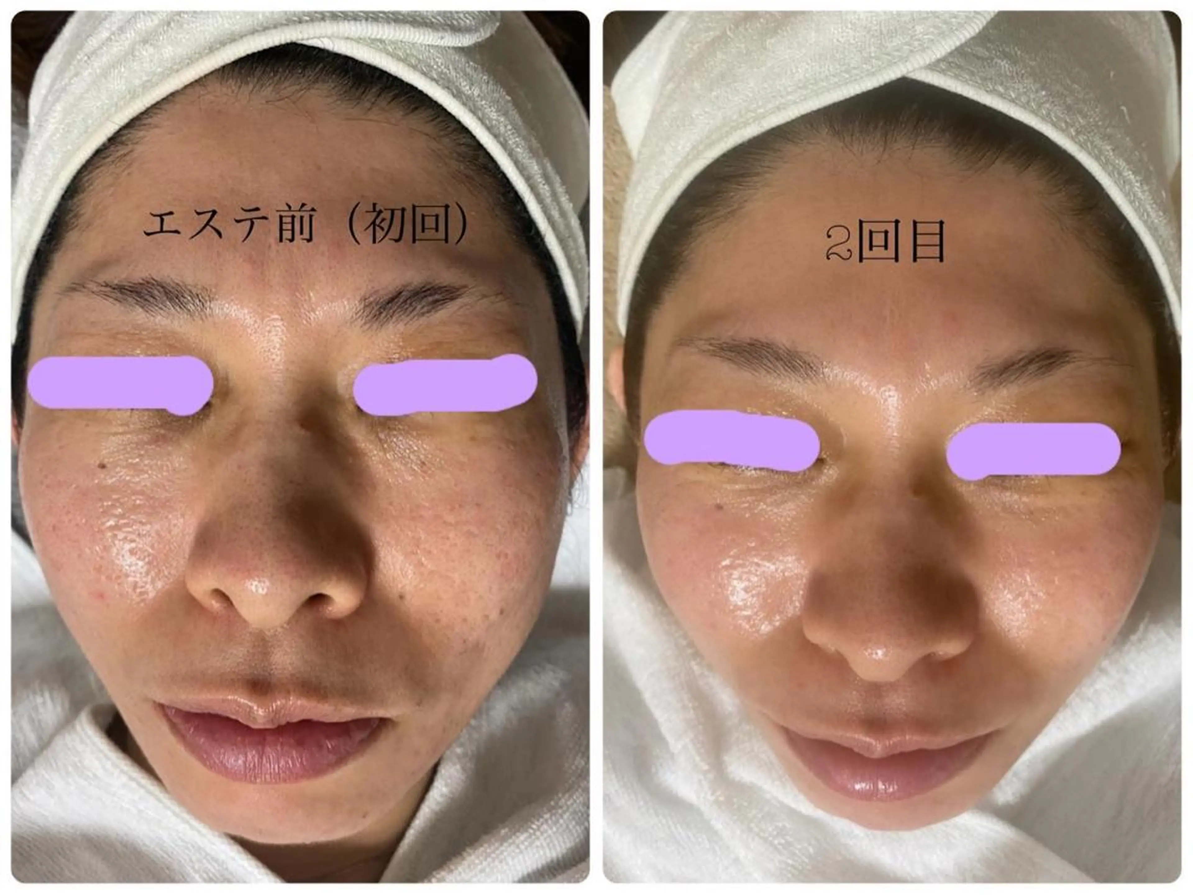 エル美容室所属・oshima yuukiのマツエク・マツパデザイン