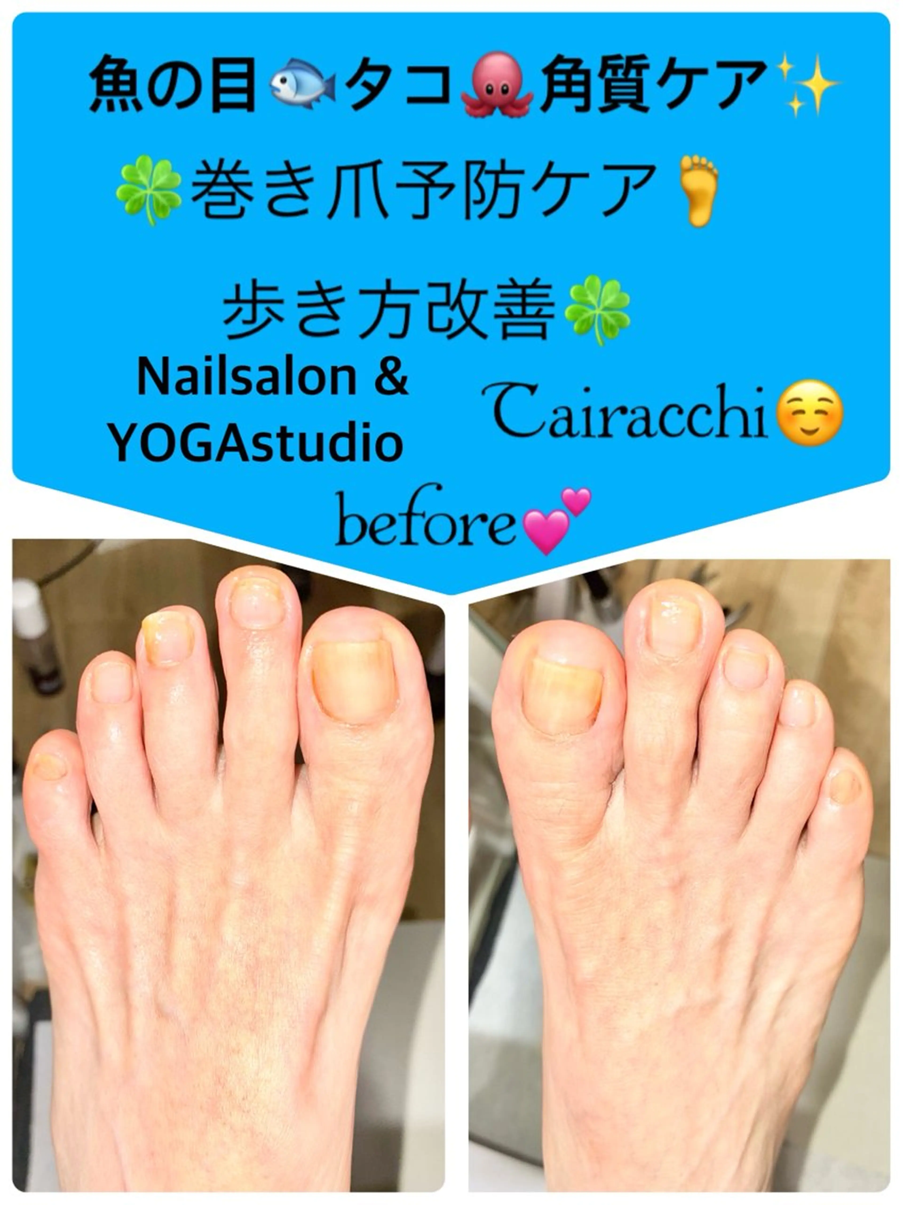 ネイル フットネイル フットネイル Tairacchi ﾀｲﾗｯﾁのネイルデザイン