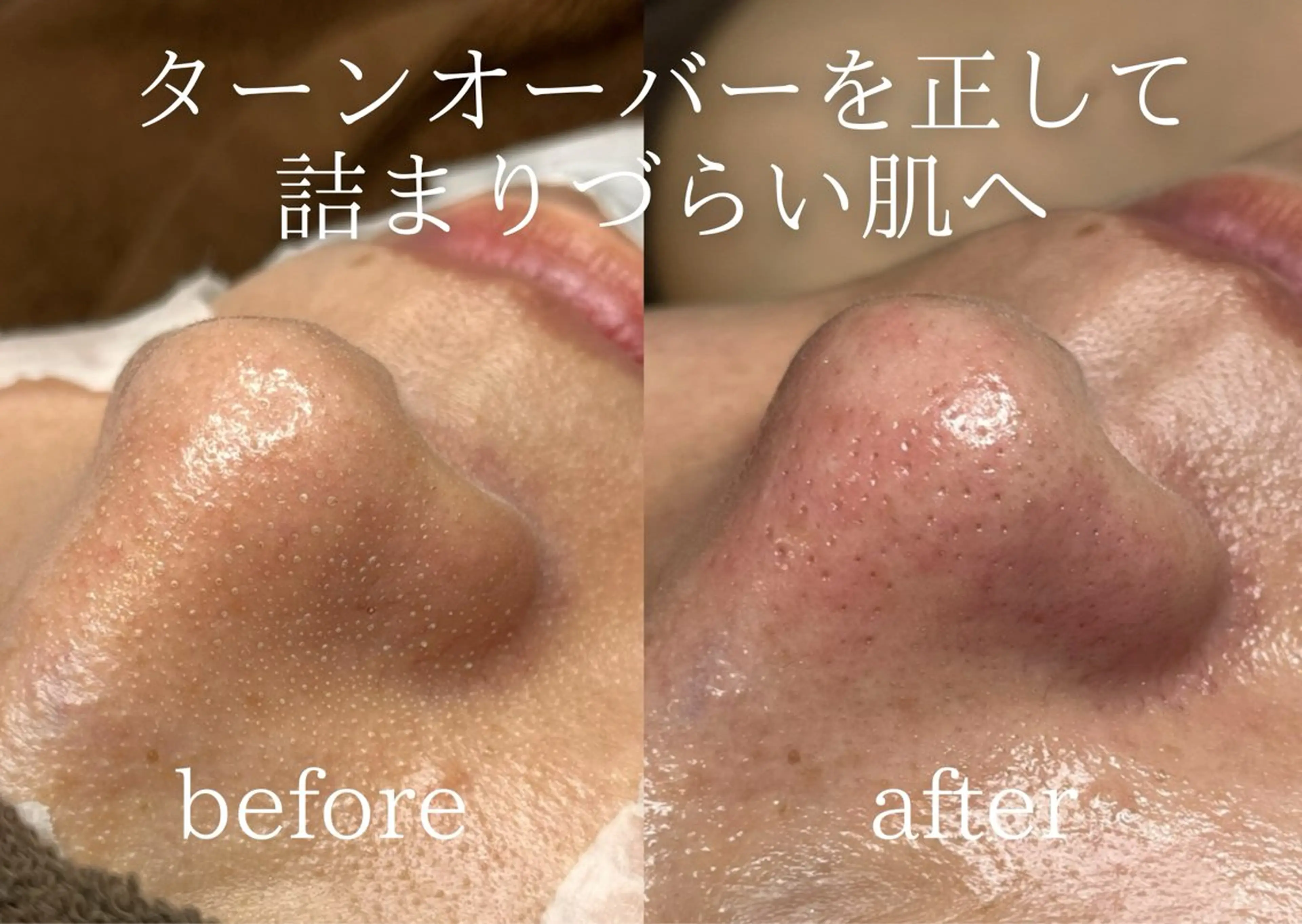 エステ Peerless所属・菅原 智香のエステ・リラクイメージ