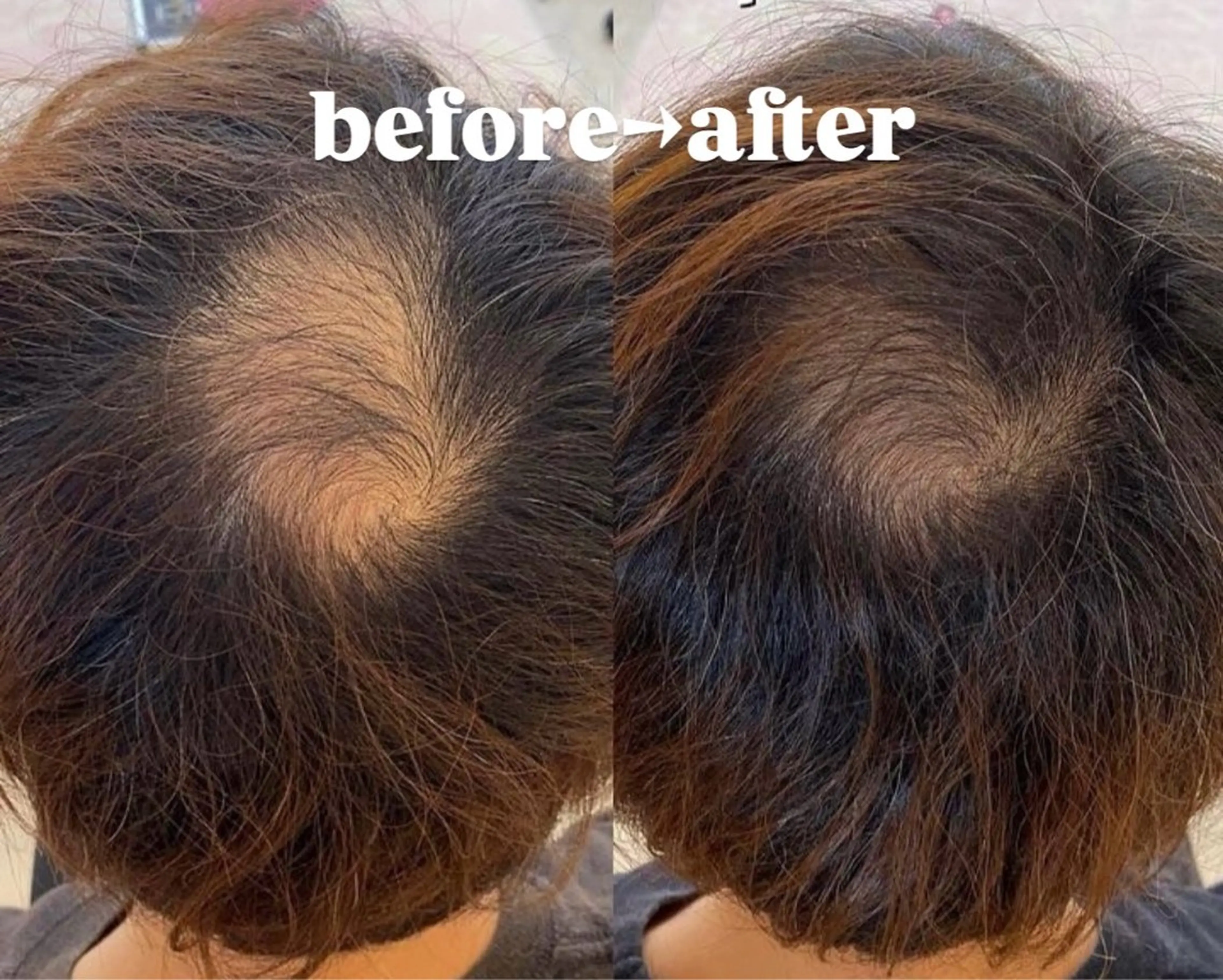 Skincare Room〜Caaka〜所属・橋本 千寿のエステ・リラクイメージ