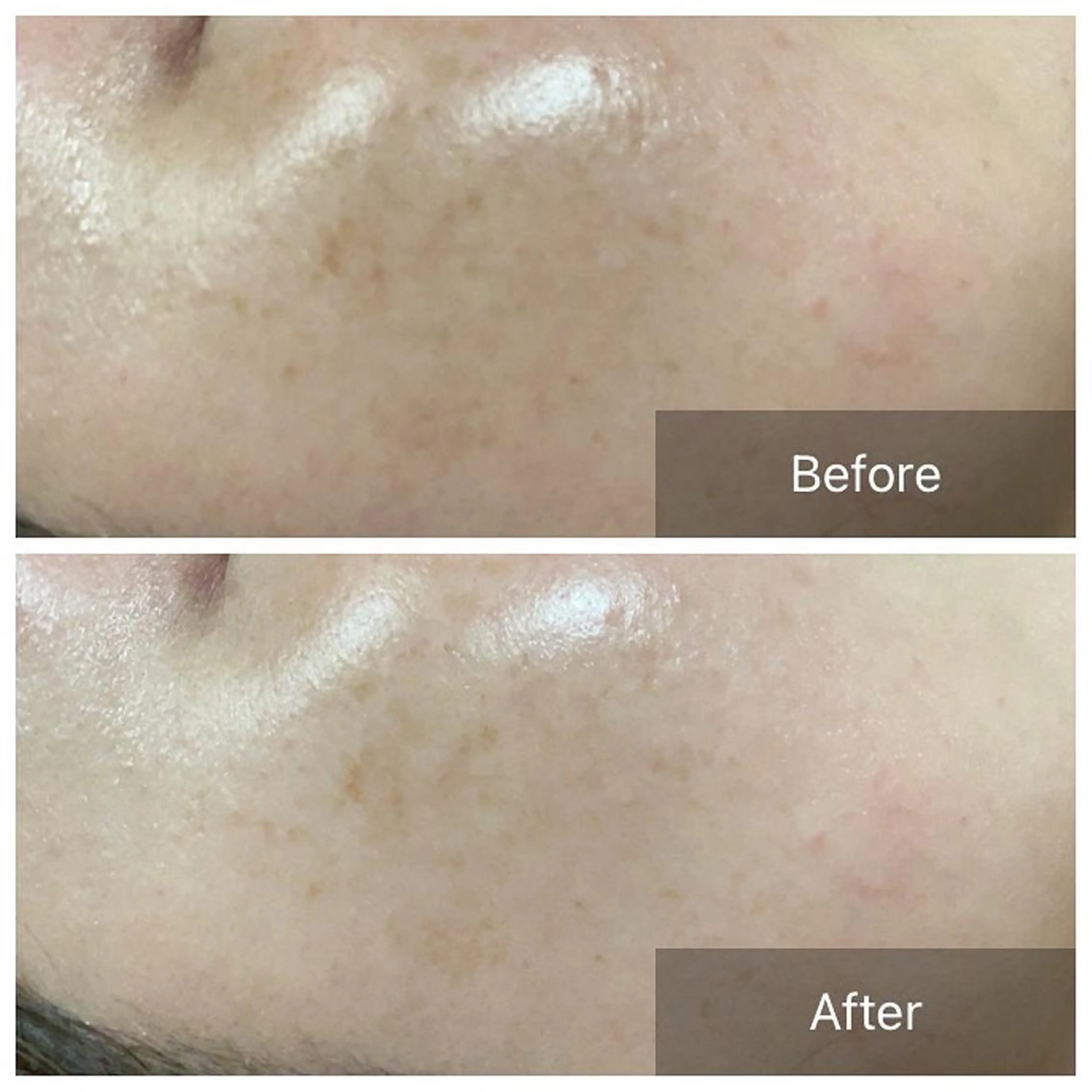 Lumiere despoir所属・Lumiere despoirのエステ・リラクイメージ