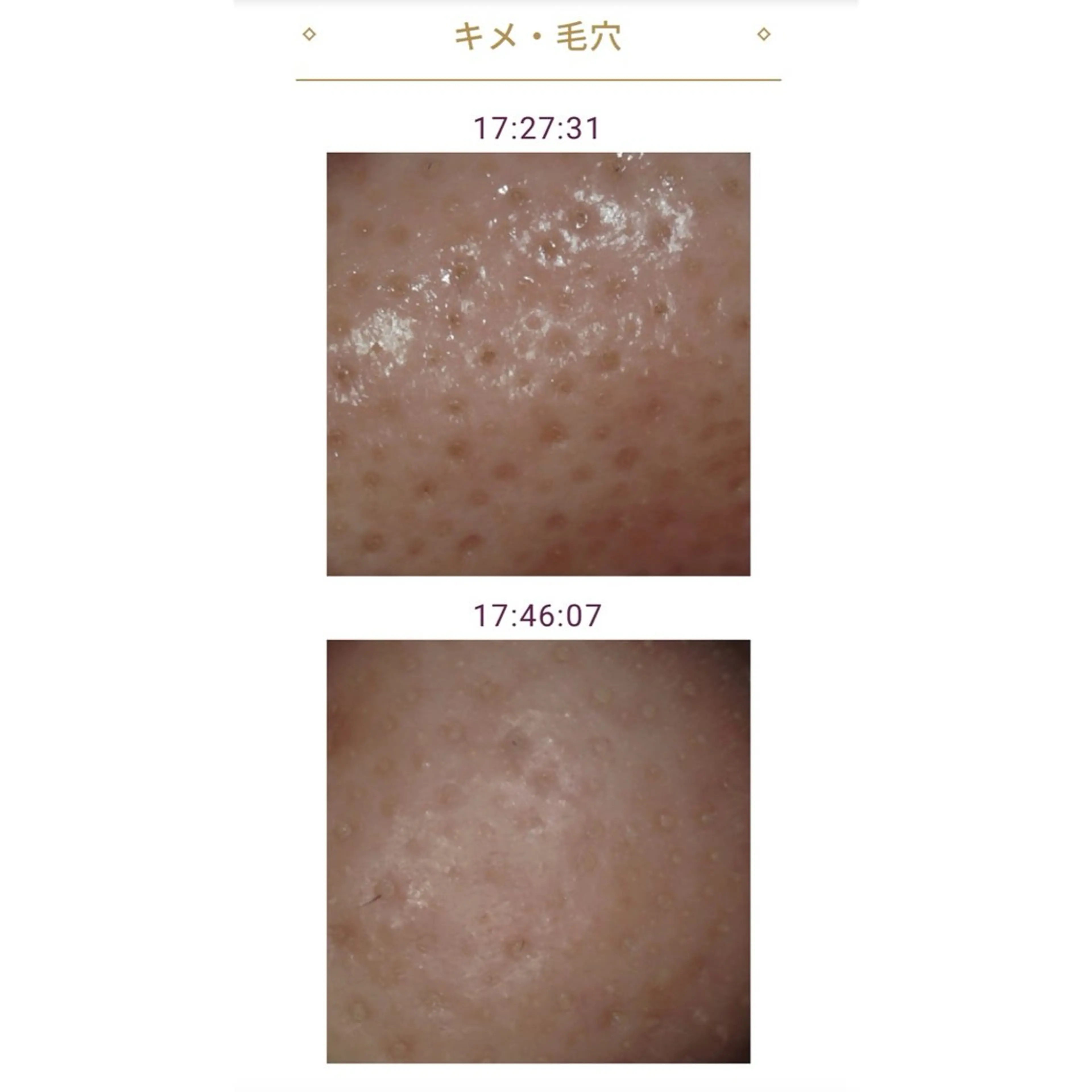 メナード瑞穂区平郷店 横山ともみのエステ・リラクイメージ