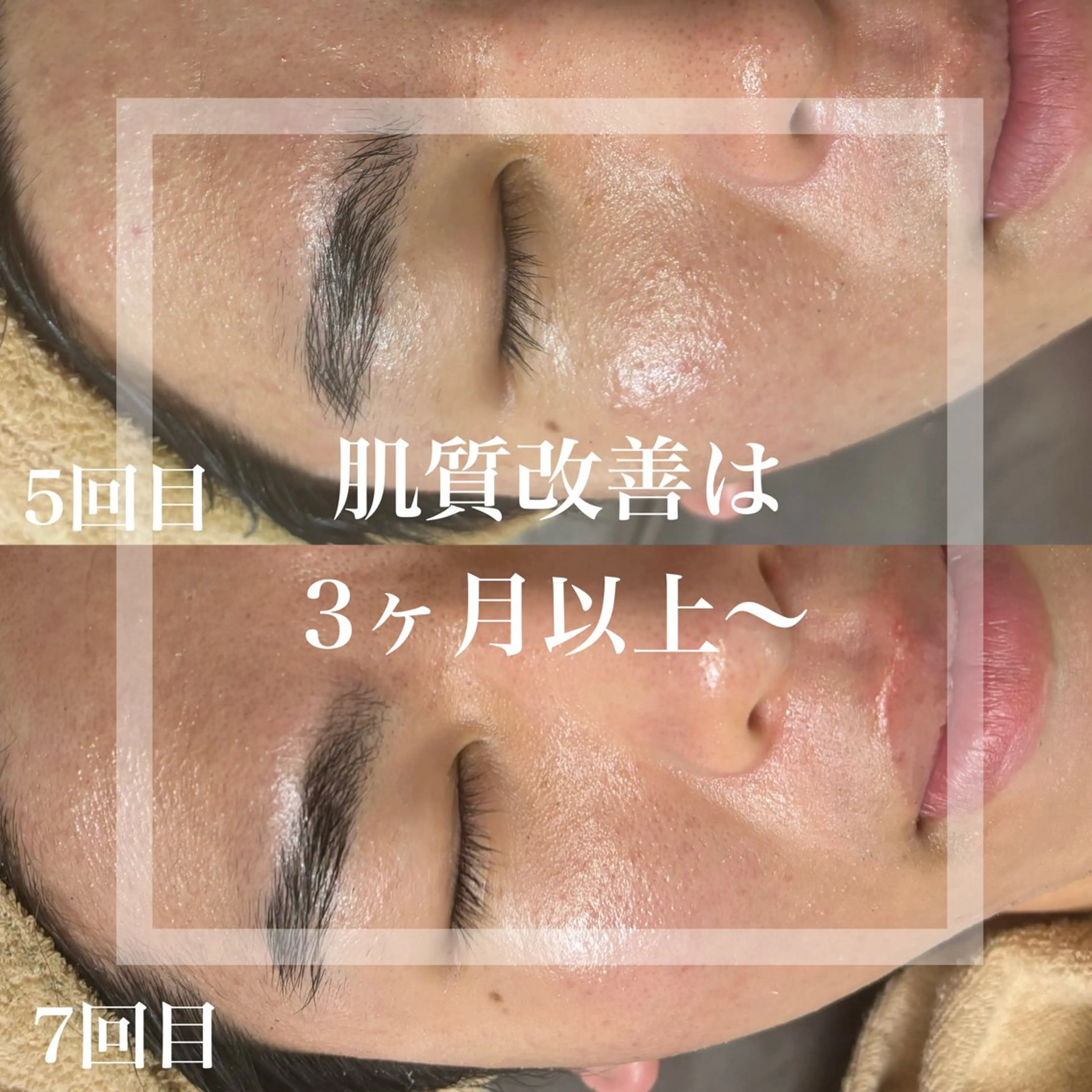 エステ WHITE AQUA 北千住店のエステ・リラクイメージ