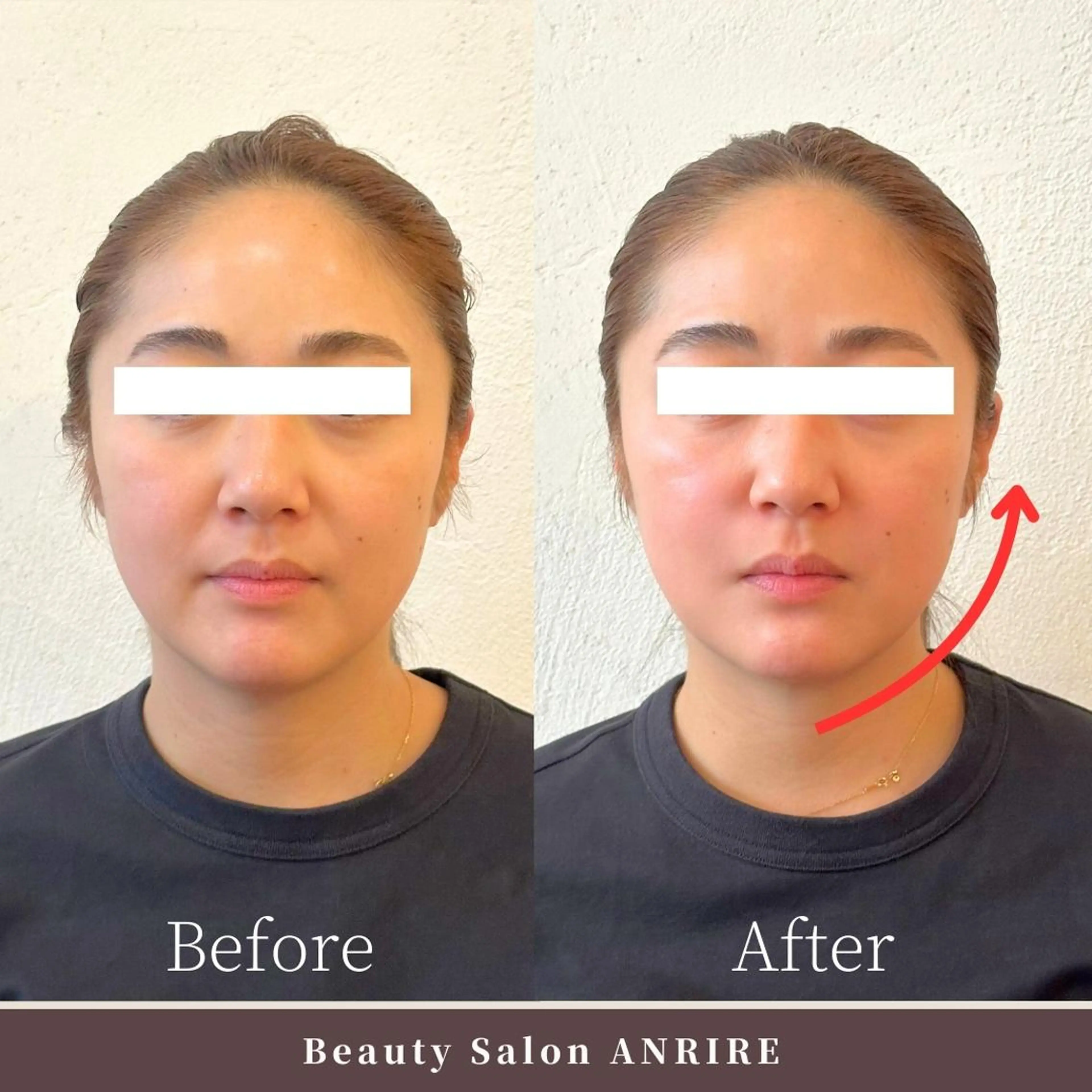 毛穴&肌荒れ&むくみレス!小顔フェイシャルの写真