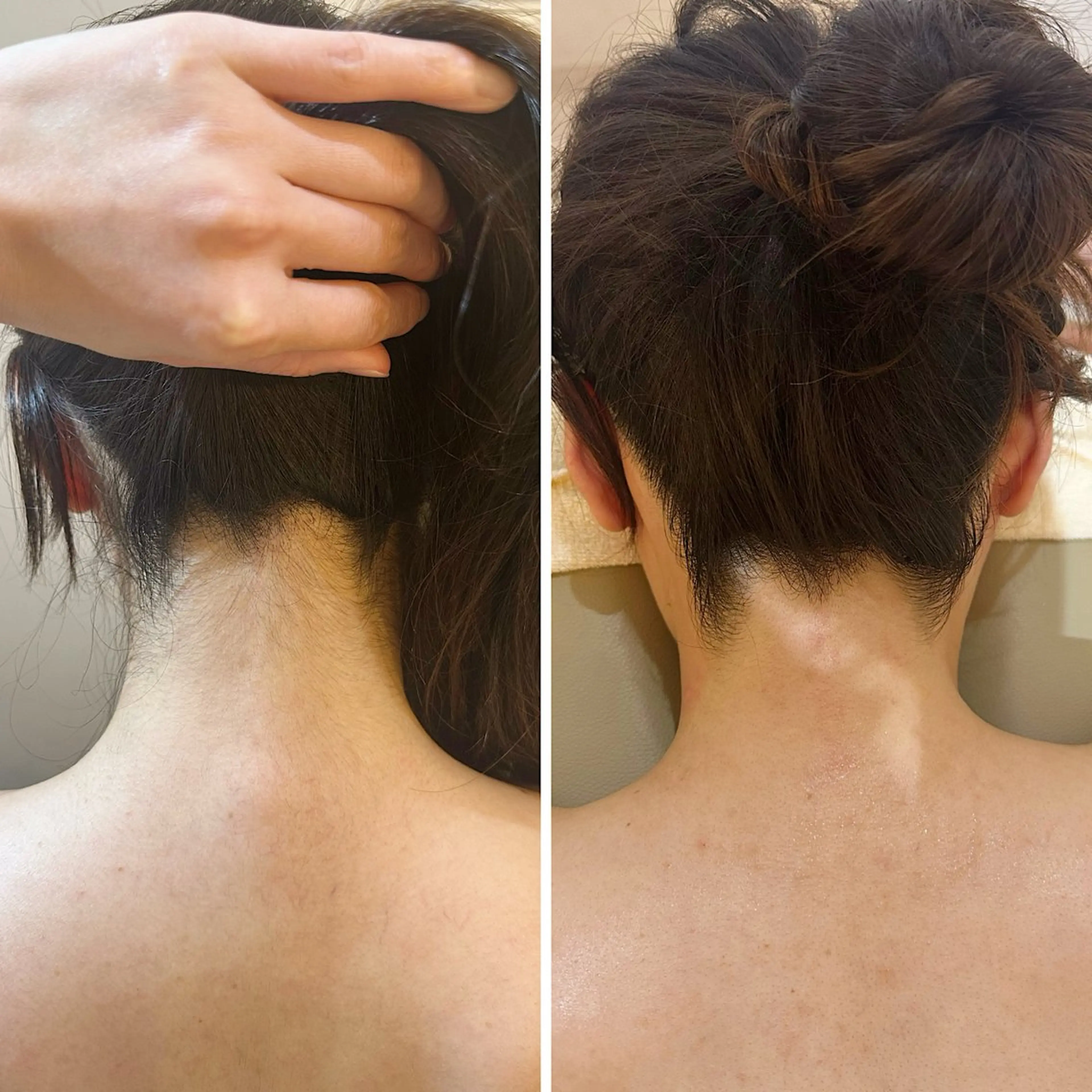 脱毛 うなじ脱毛/美肌脱毛 LABELのエステ・リラクイメージ