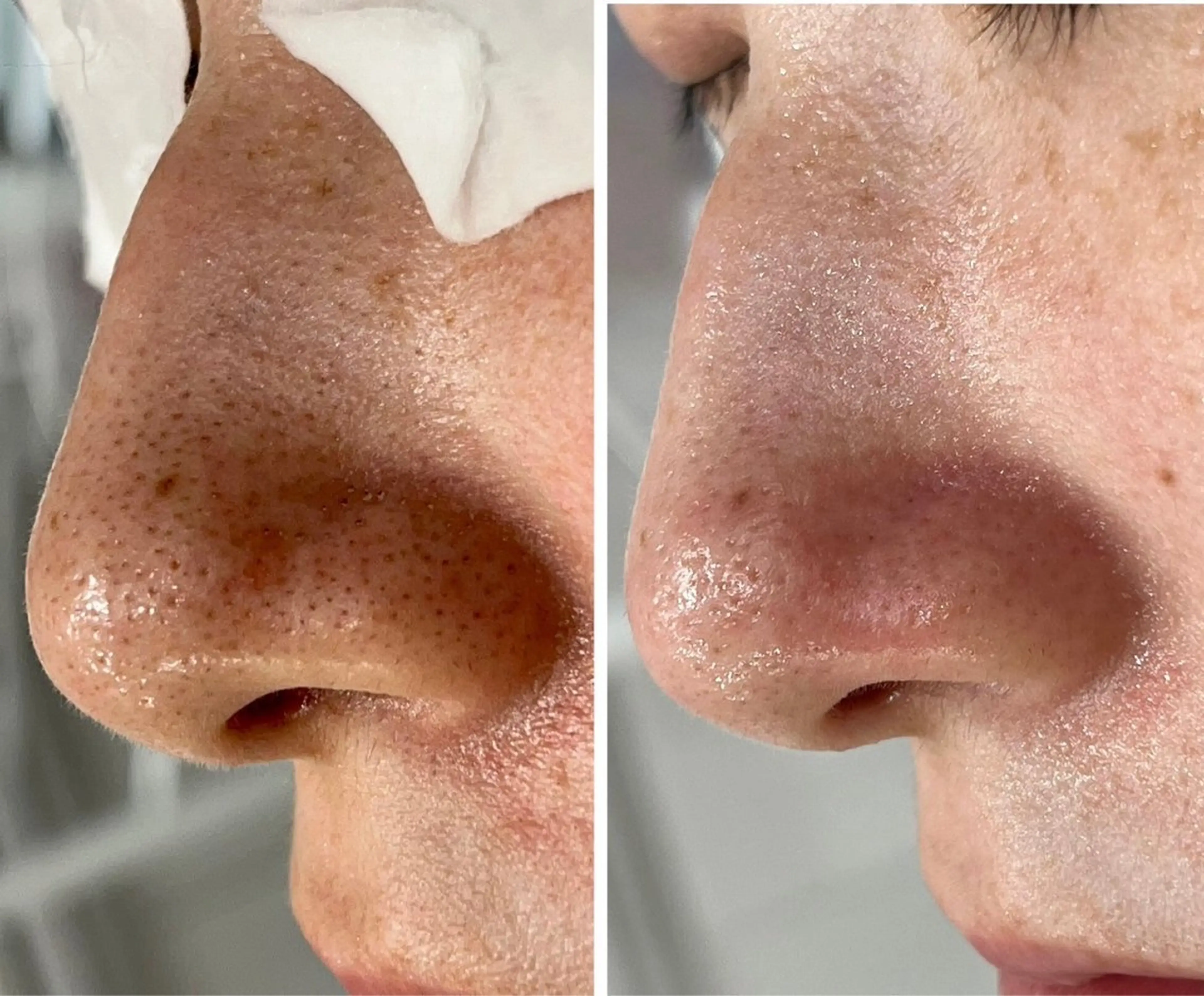 NOAH 小顔毛穴 川越店所属・NOAH ORIEのエステ・リラクイメージ