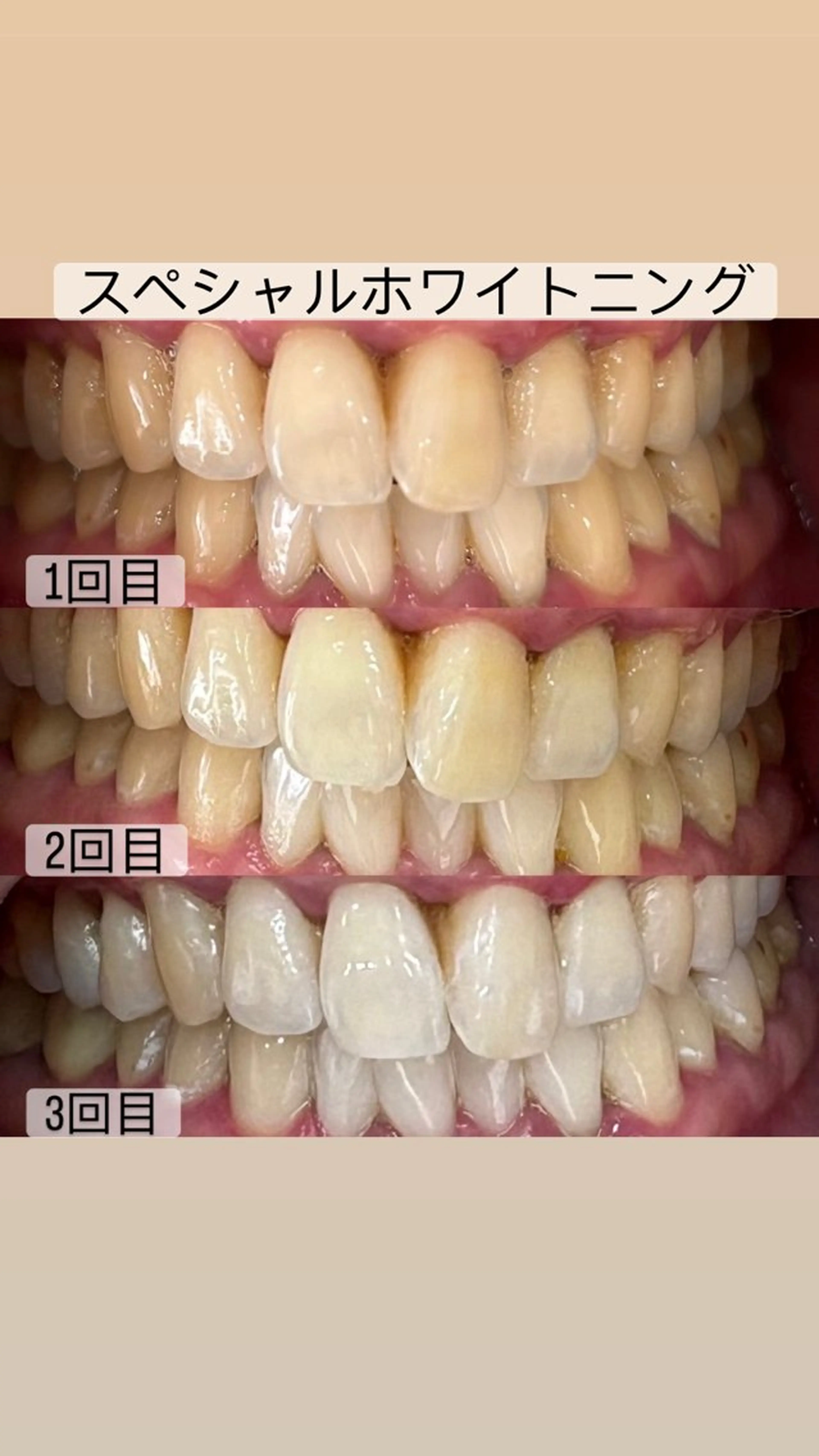 その他 whitening salon yatto.所属・ホワイトニングサロン yatto.のその他イメージ