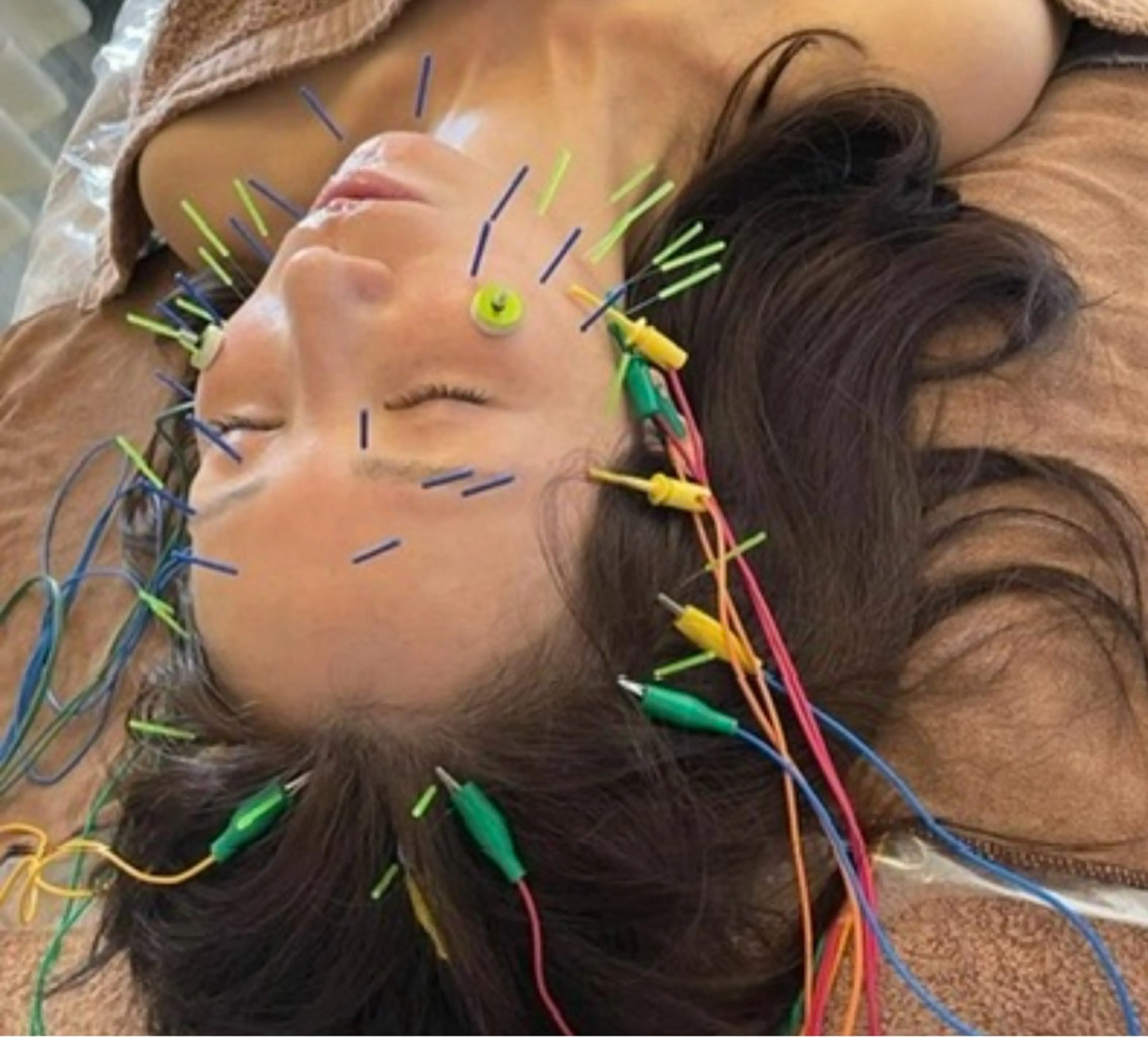 エステ リラク 美容鍼灸サロン mahoroba院長のエステ・リラクイメージ