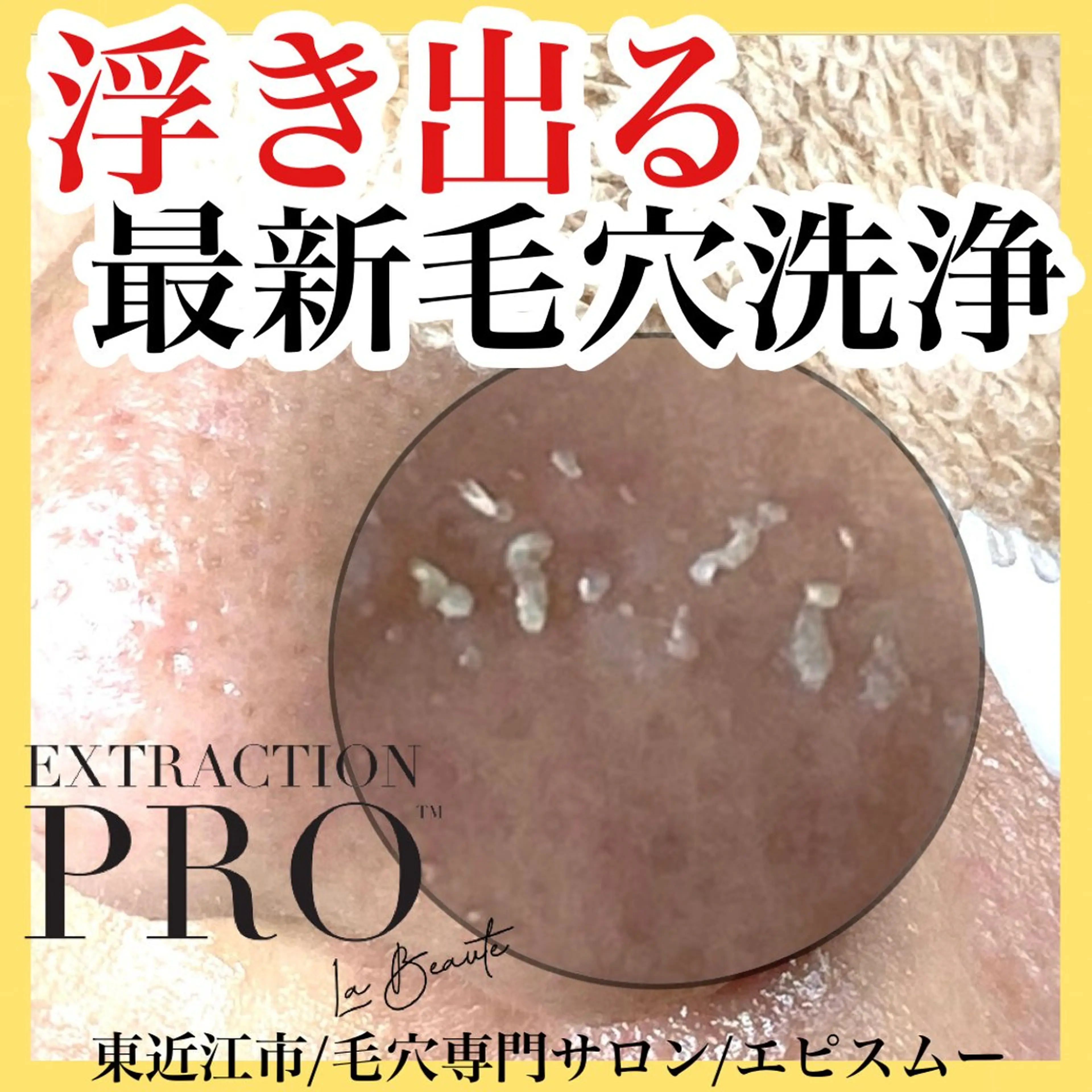 epismoo 脱毛/HBL/毛穴のエステ・リラクイメージ