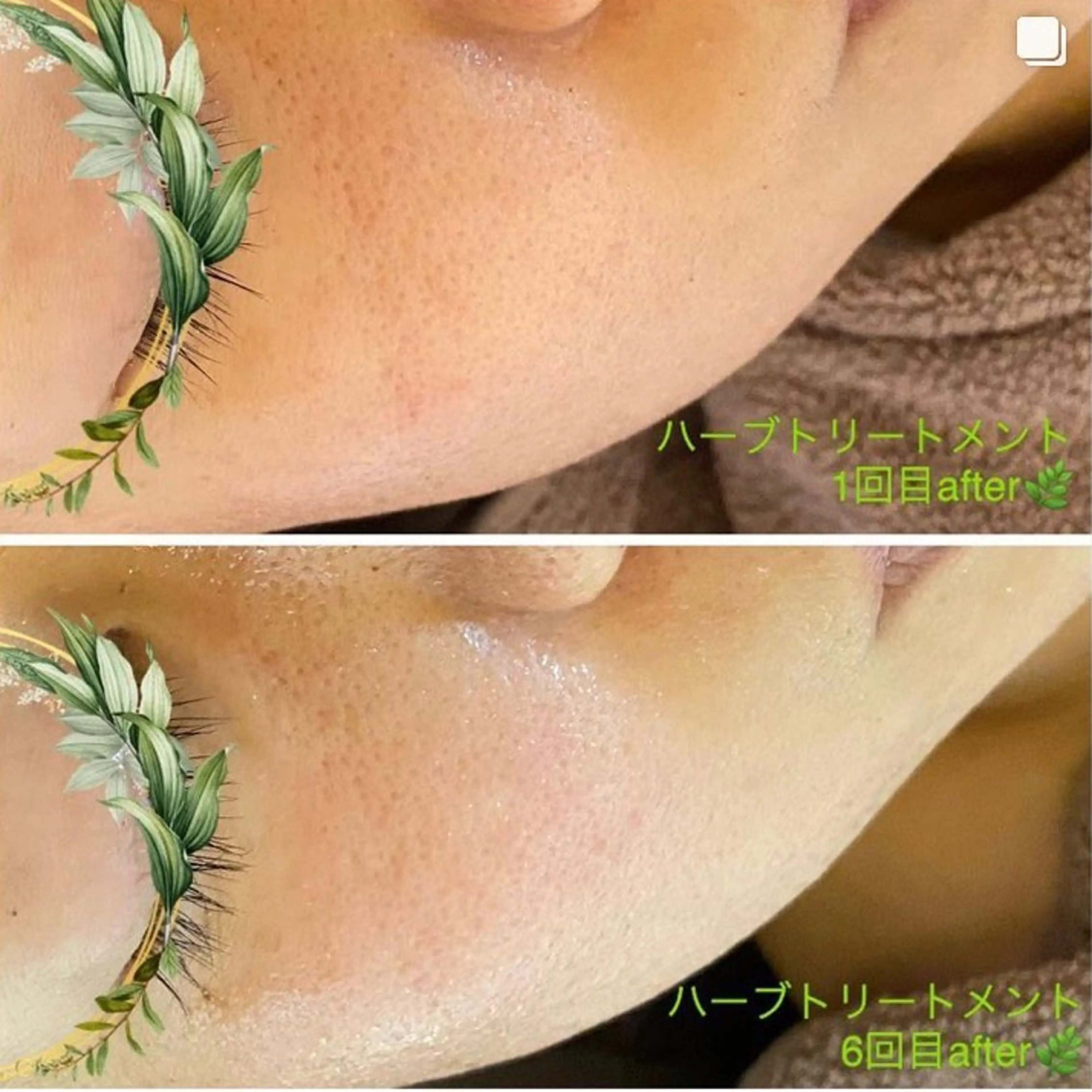 オーガニック＆ホロソフィー　エステサロンGARDEN所属・GARDEN 田辺加代子のエステ・リラクイメージ