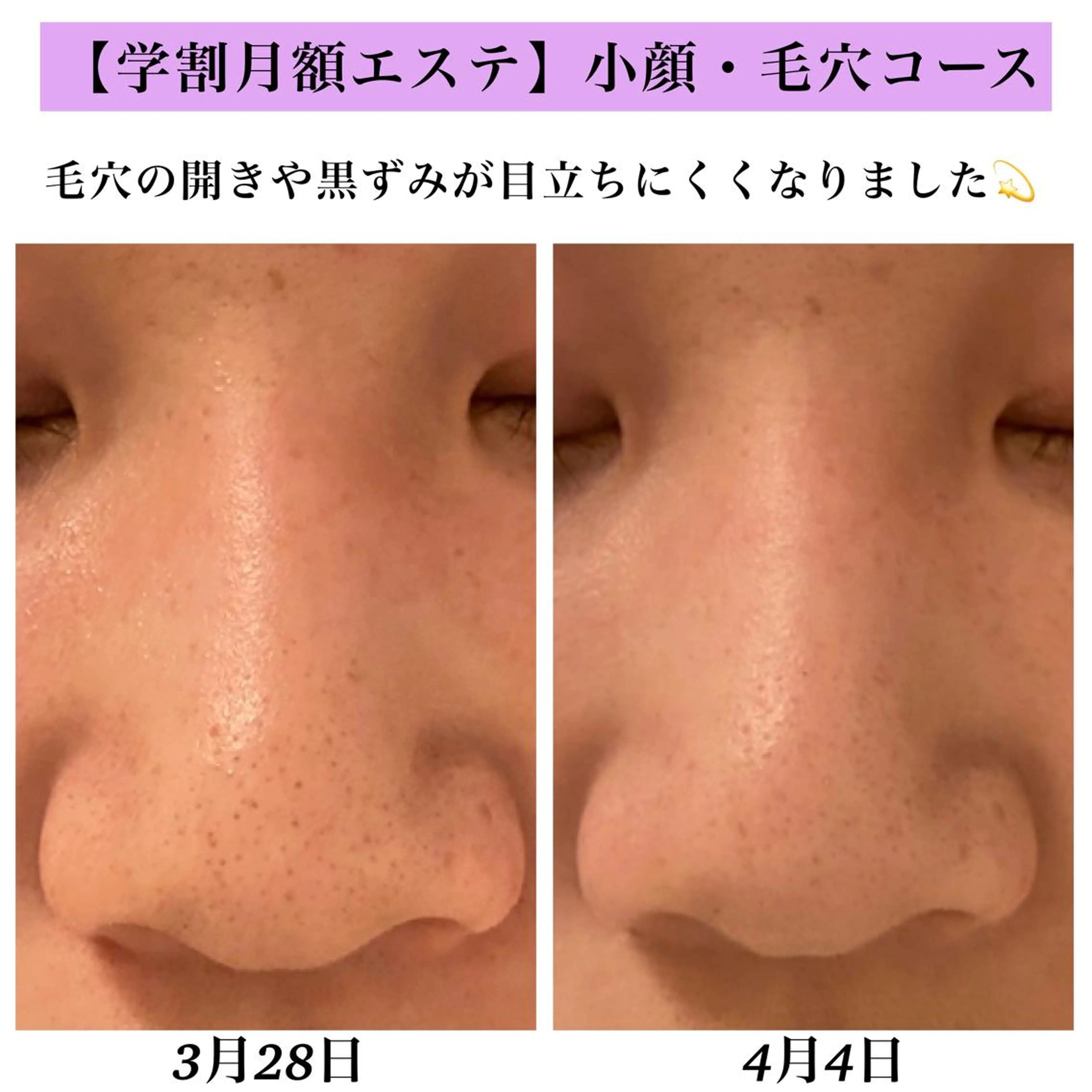 Bellesthe （ベルエステ）のエステ・リラクイメージ