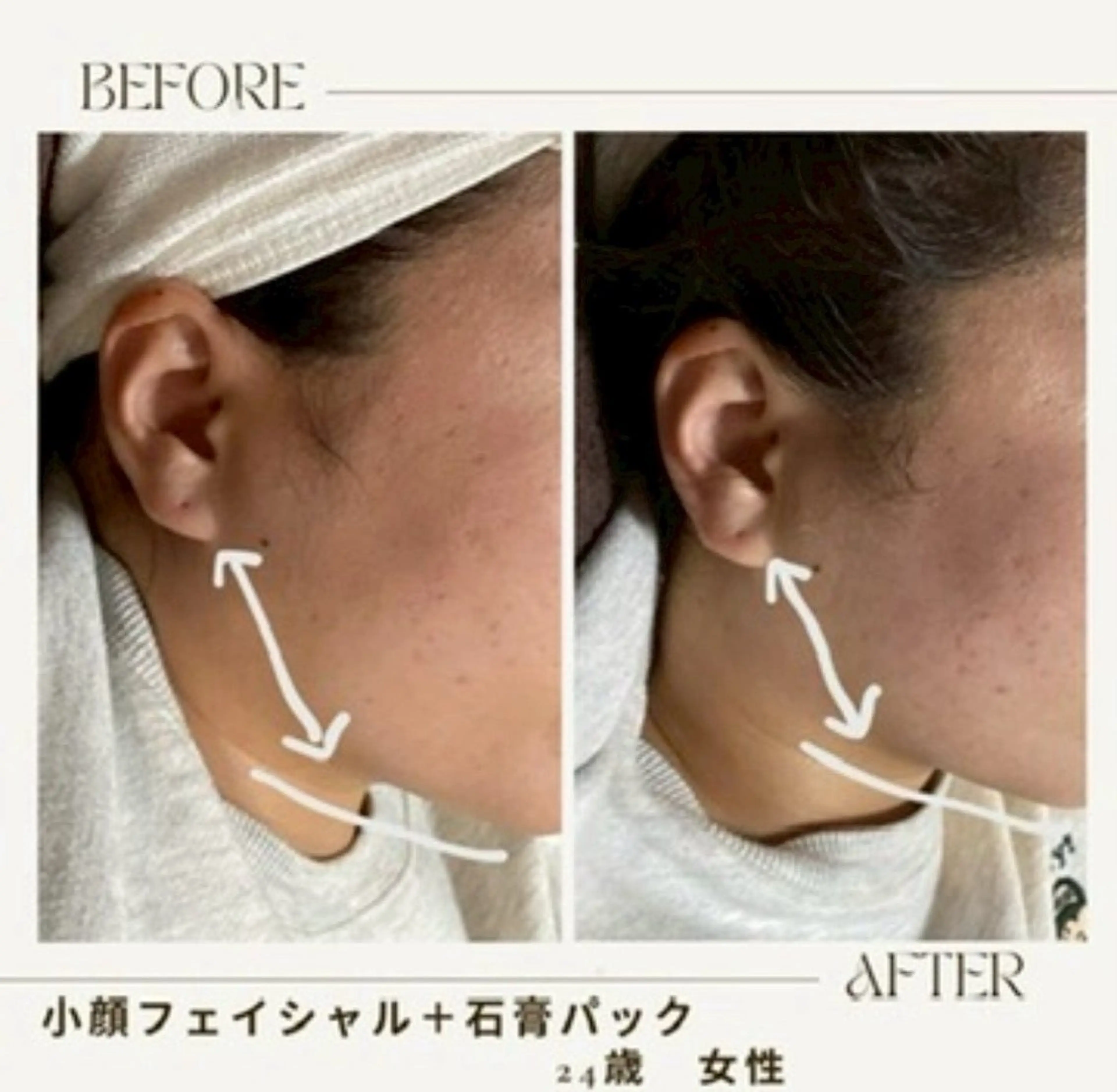 NICOLAUGH/ 村松【小顔.ボディ】のエステ・リラクイメージ