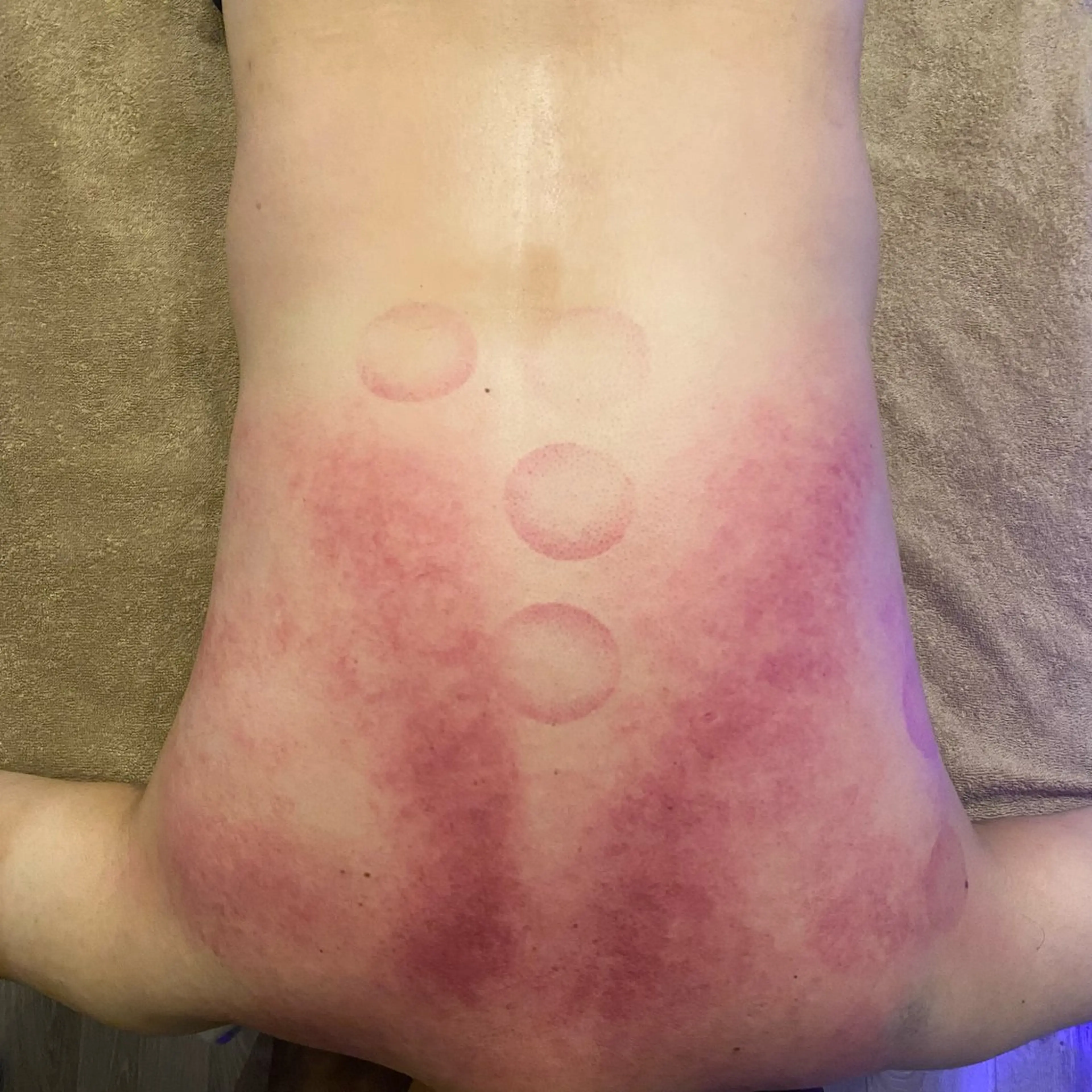 エステ リラク GRACEZ ｸﾞﾚｰｼｽﾞのエステ・リラクイメージ