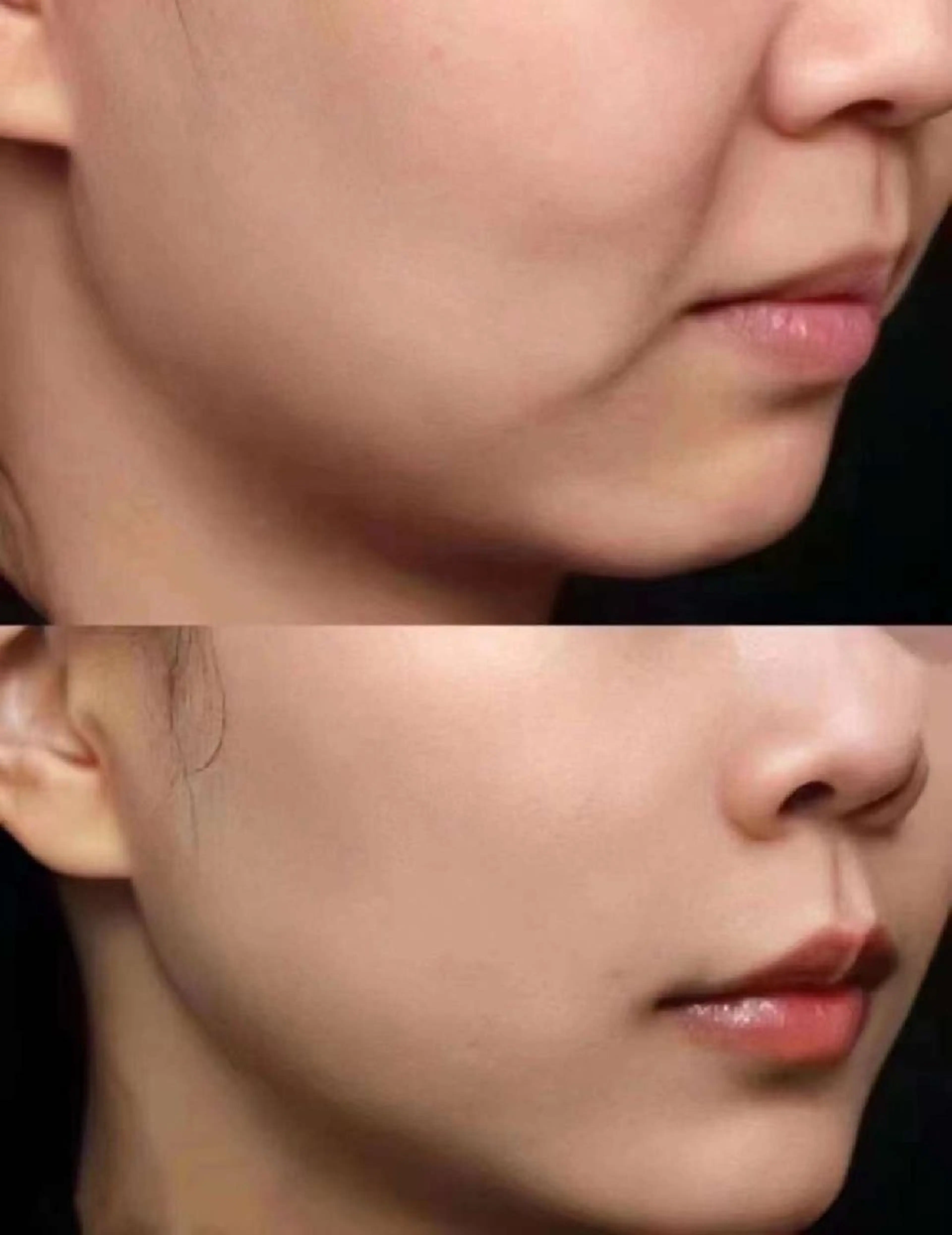 ネイル ブライダルネイル ホワイト aliaハイフ&水光ジェットサロン所属・aliaハーブ水光店 エステティシャン募集のエステ・リラクイメージ