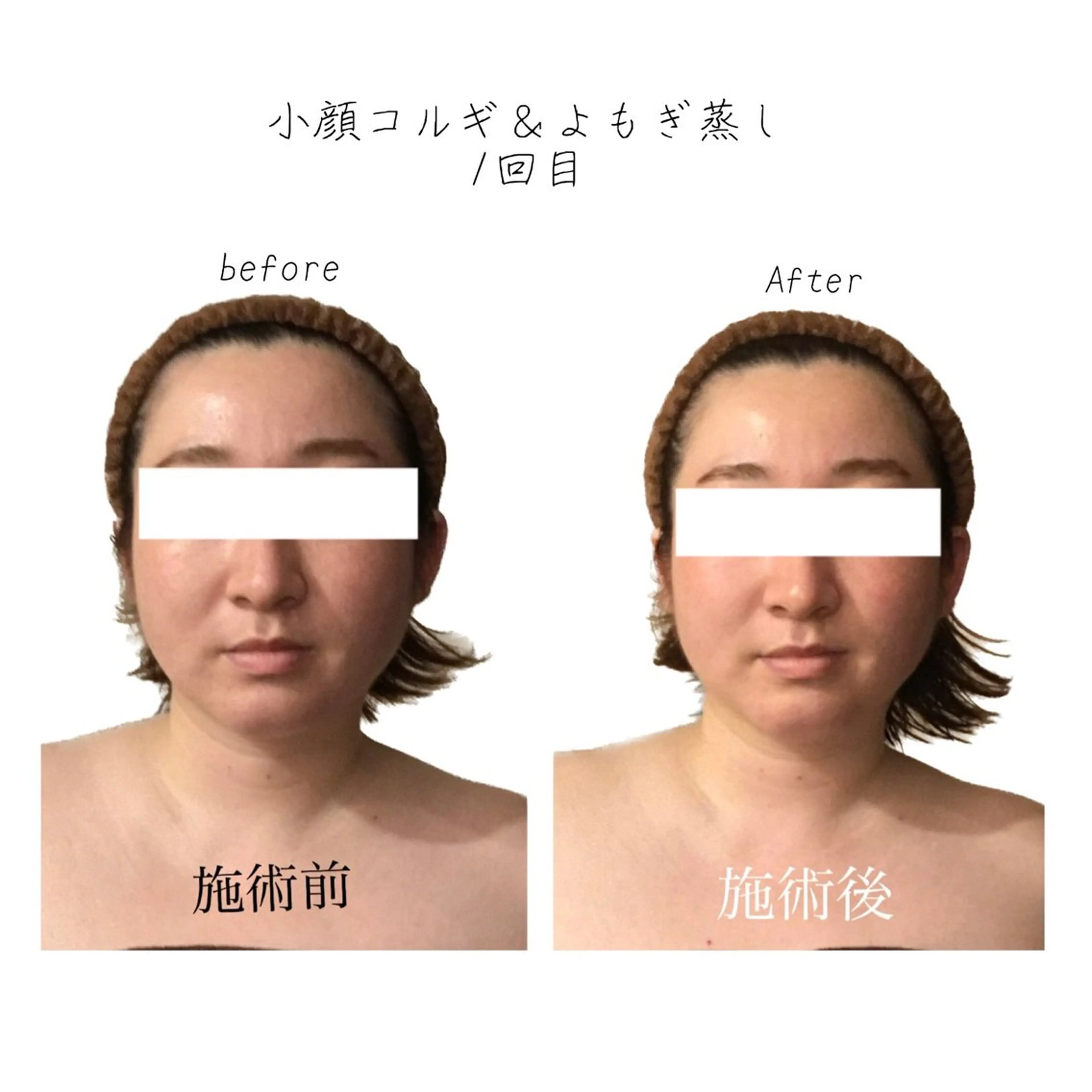 エステ リラク 小顔コルギ専門店/隠れ家サロン《여름ヨルム》所属・小顔コルギ専門店 《ヨルム》龍ケ崎店のエステ・リラクイメージ