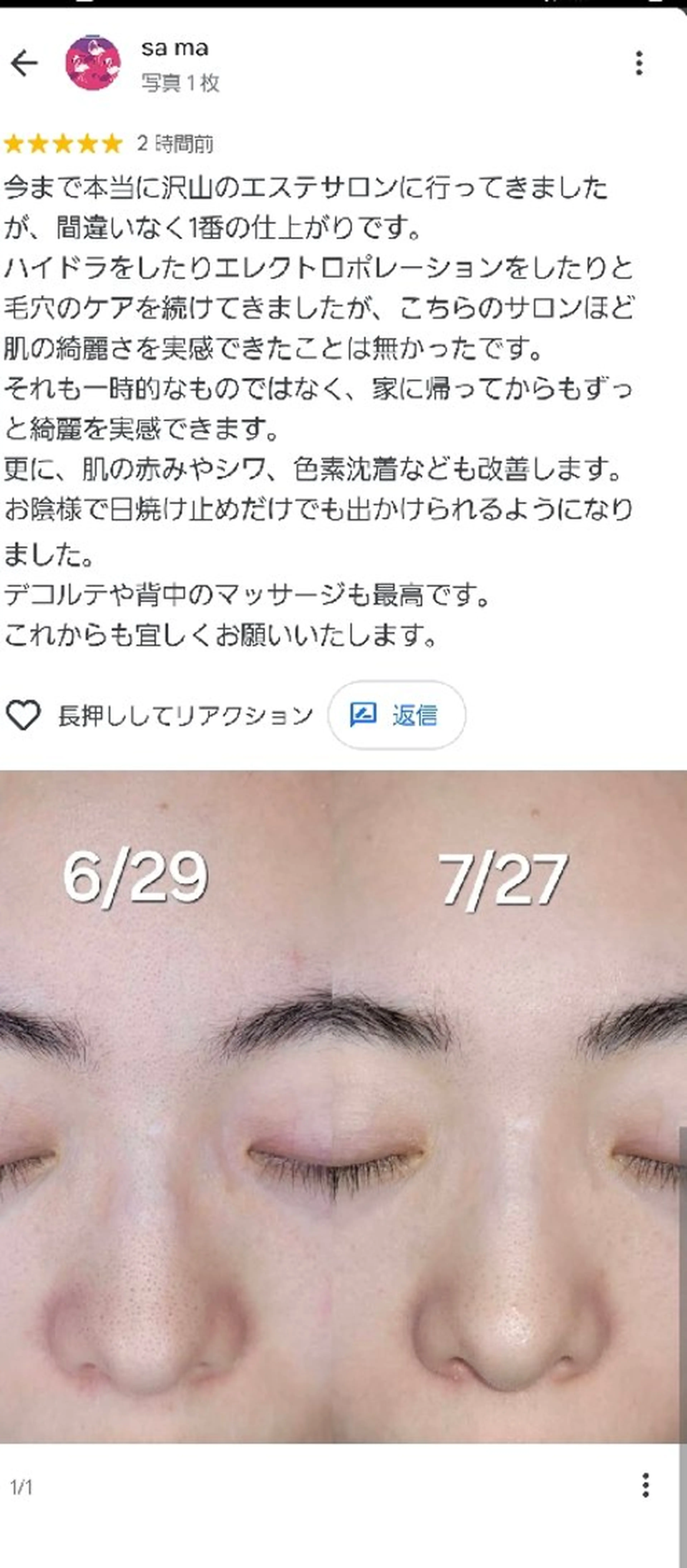 era: kayla 毛穴・ニキビ改善のエステ・リラクイメージ