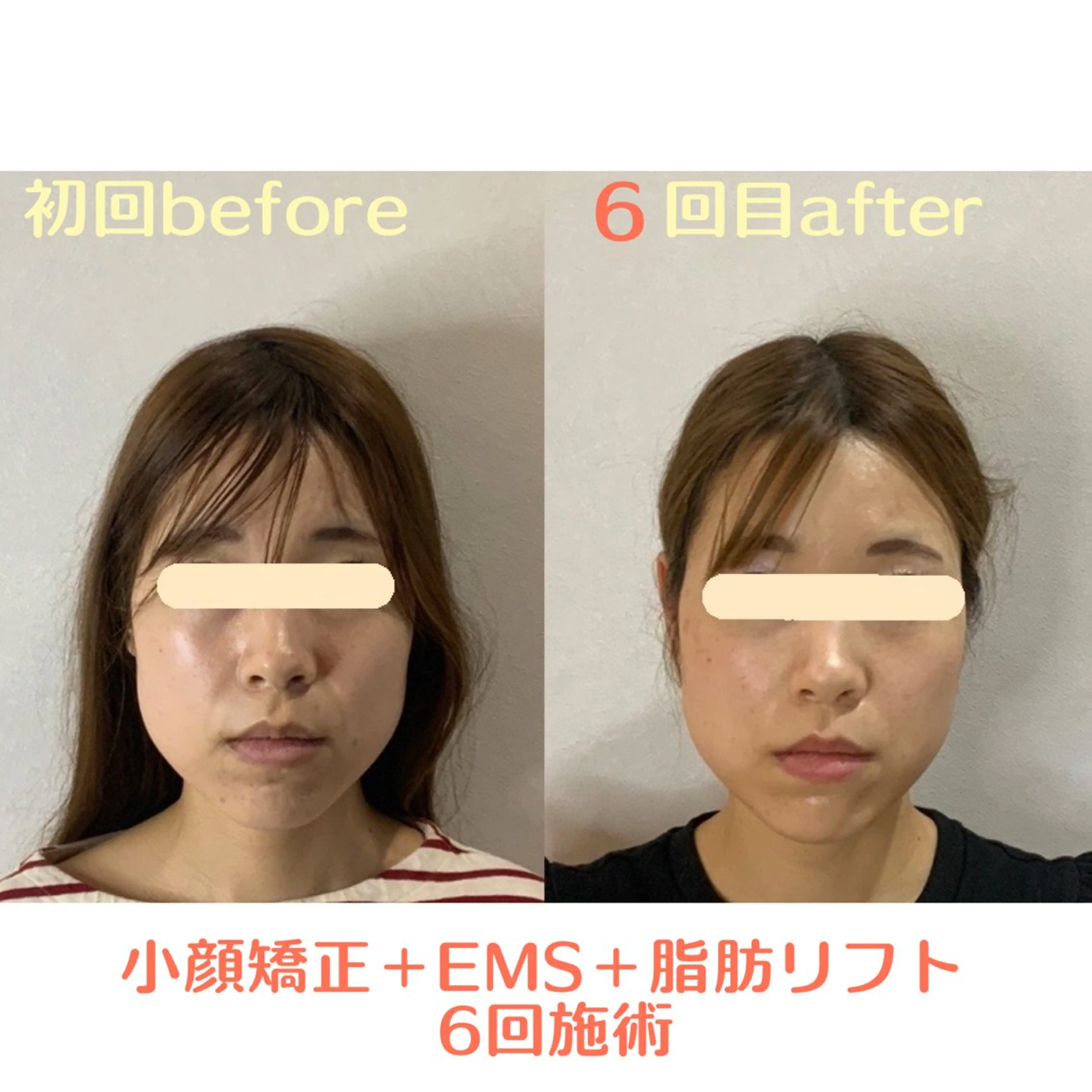 エステ 最速小顔・肌質管理 ❣️エスポワールのエステ・リラクイメージ