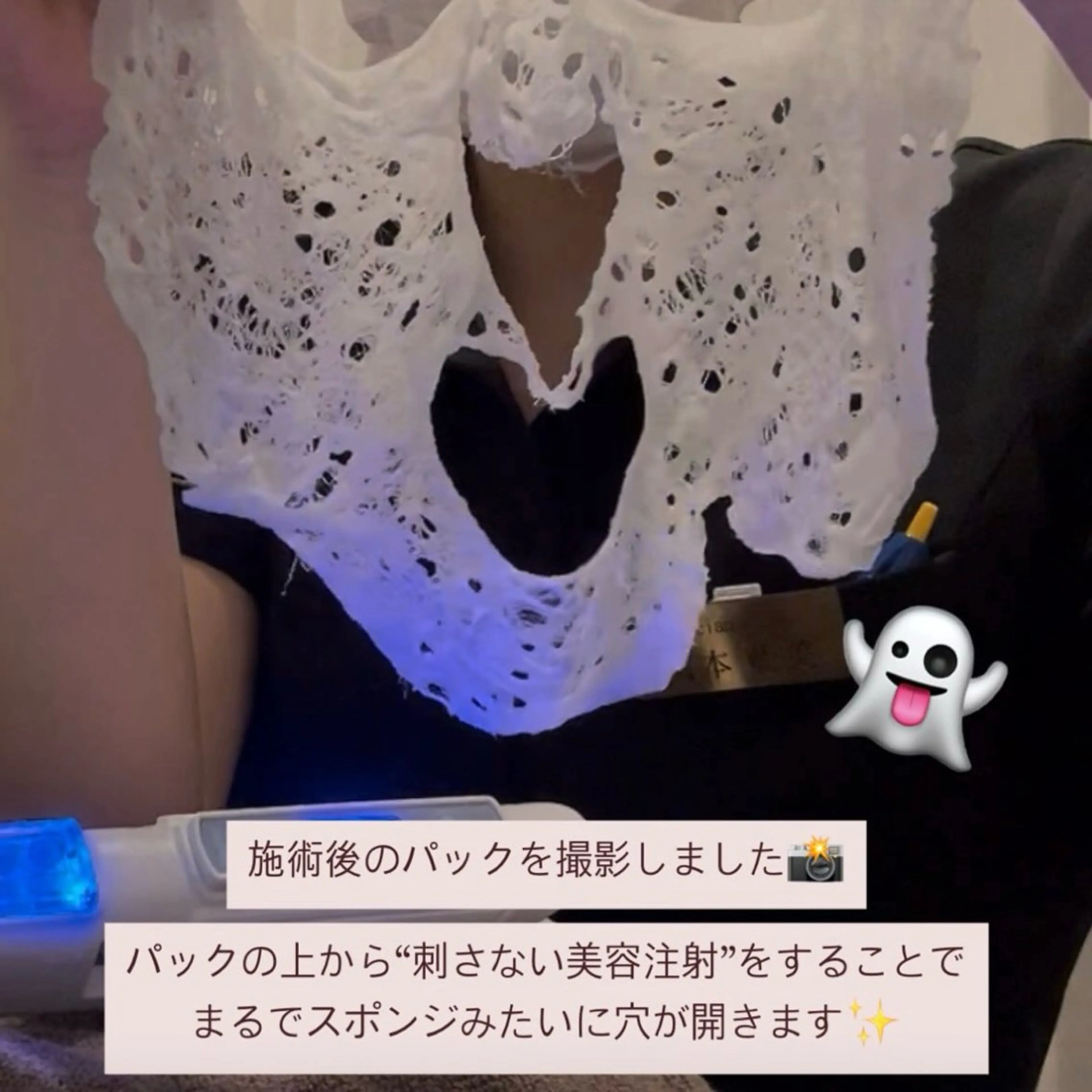 エステ MORE BEAUTY ESTHE 本通り店所属・【シミ・シワ専門店】 山本 藍美のエステ・リラクイメージ