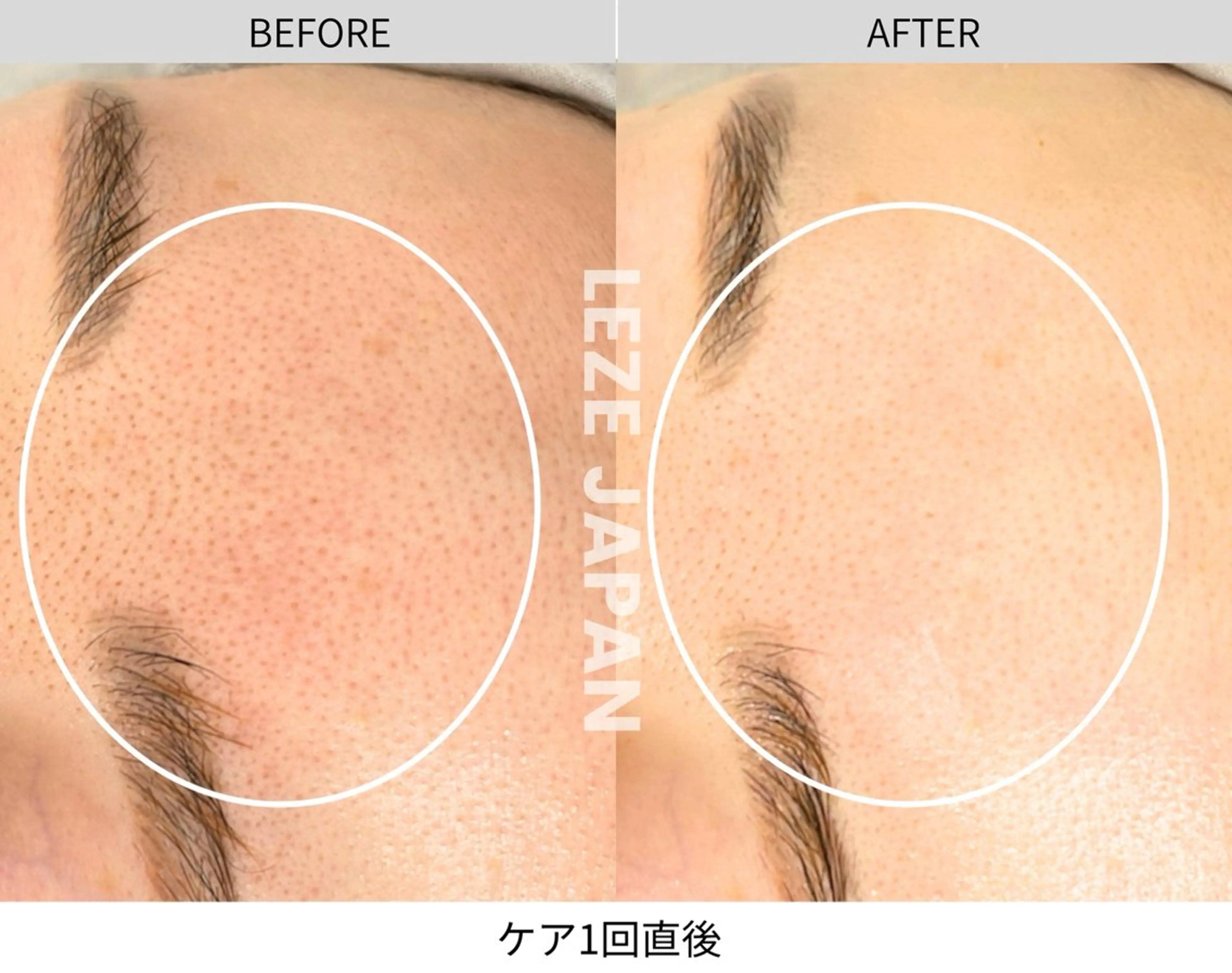 LA CLARTE所属・LA CLARTEのエステ・リラクイメージ