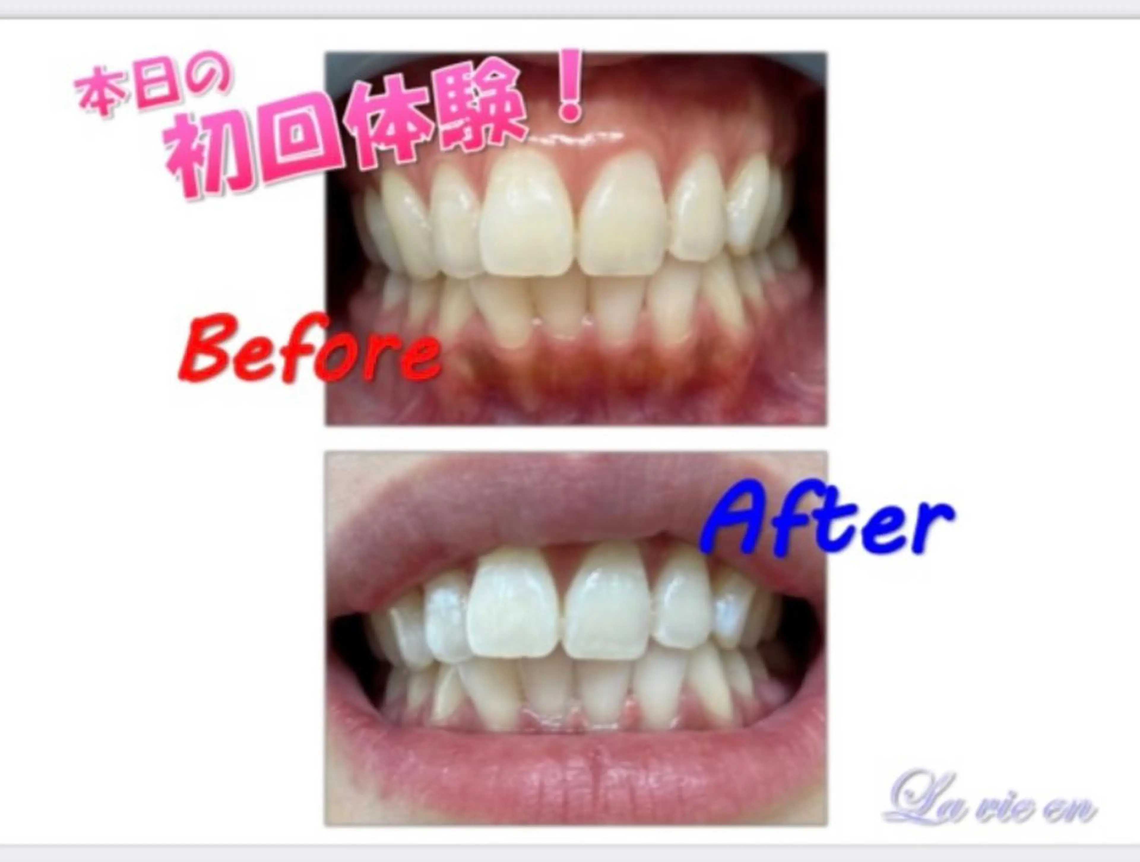 その他 セルフホワイトニングサロン　ラヴィアン所属・ホワイトニングサロン La vie enのその他イメージ