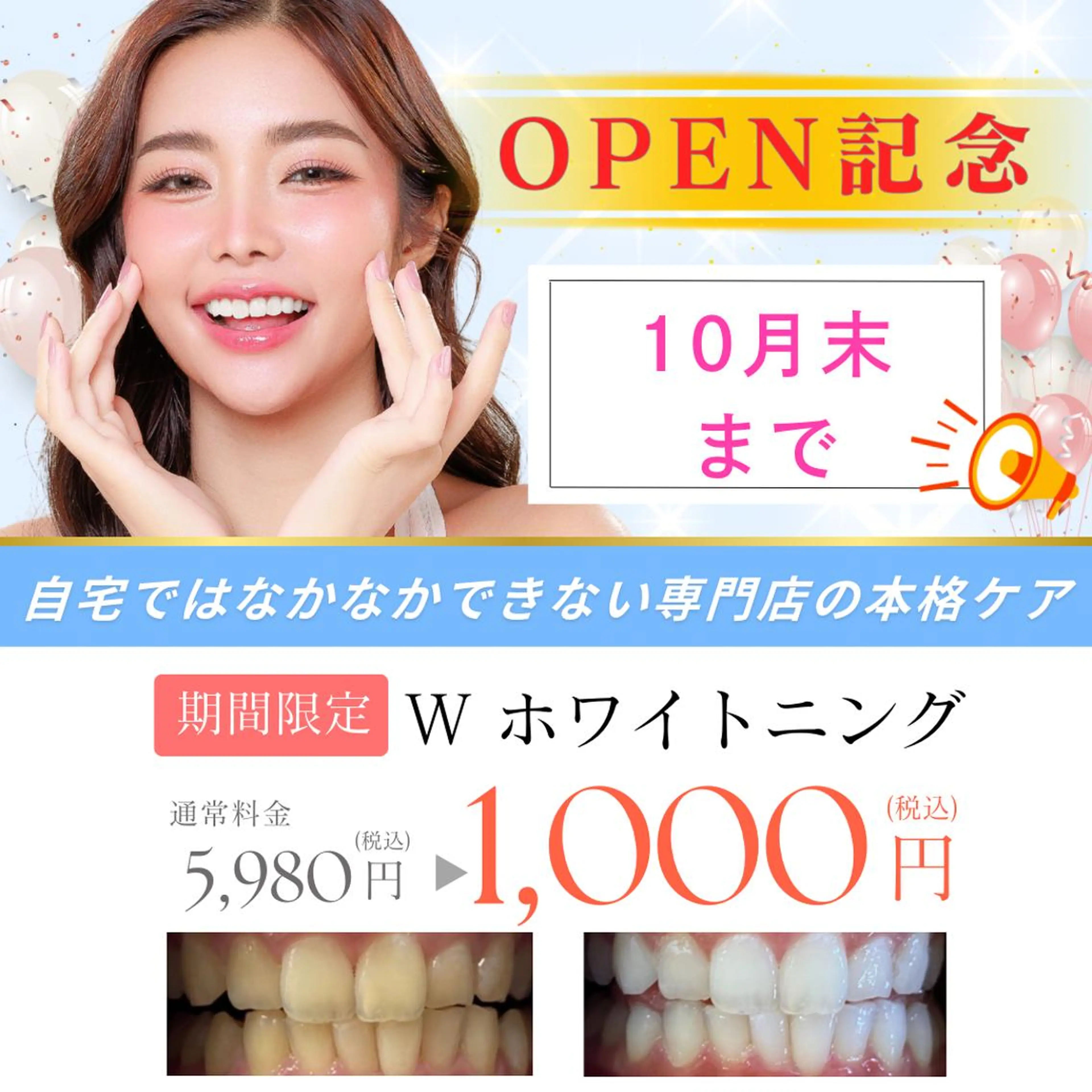 【OPEN記念🎊】 VIPホワイトニング20分×2回照射　通常¥7,980→¥1,000の写真