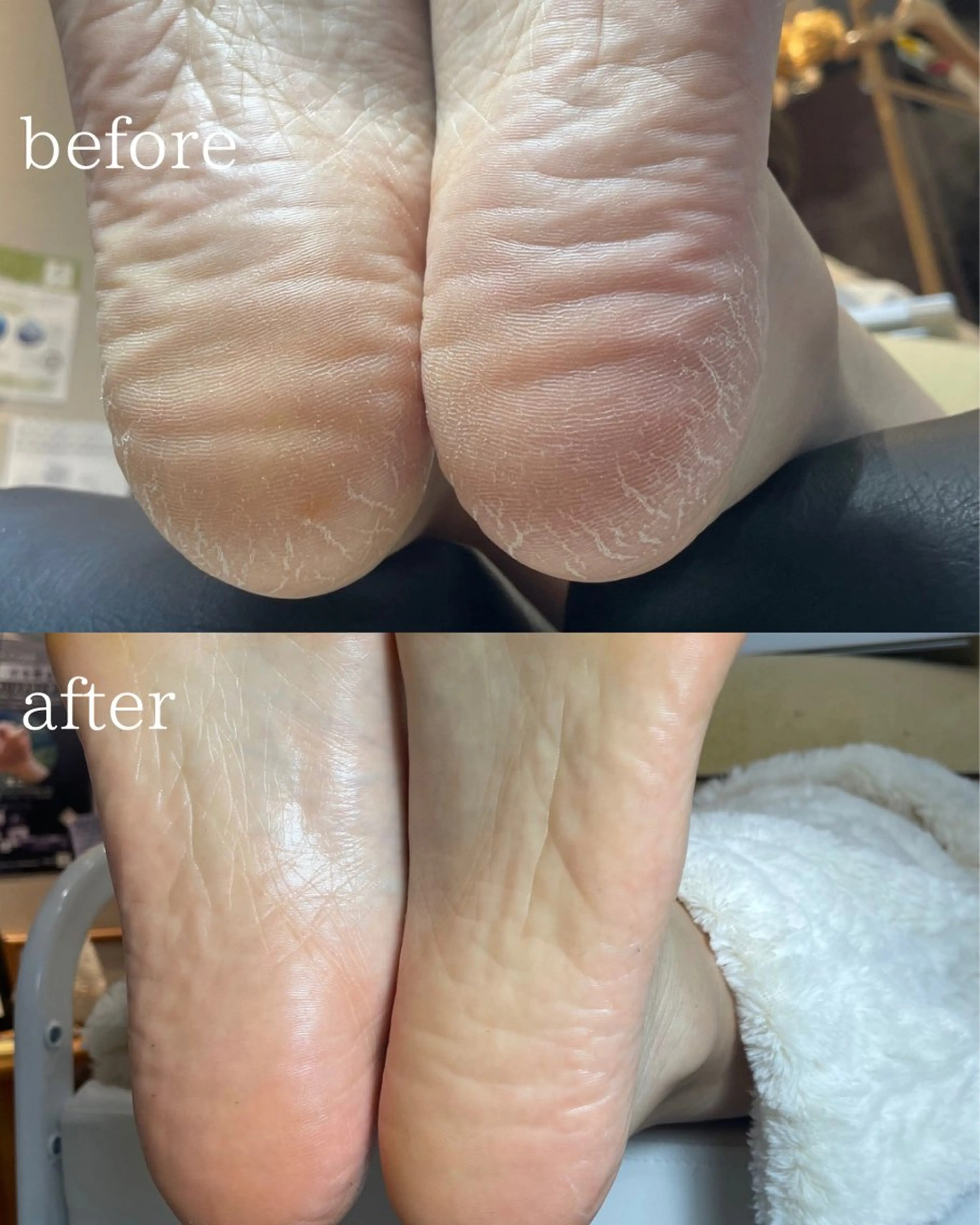 Nail atelier Litom【ネイルアトリエリトム】所属・相模原ネイル Tomoのネイルデザイン