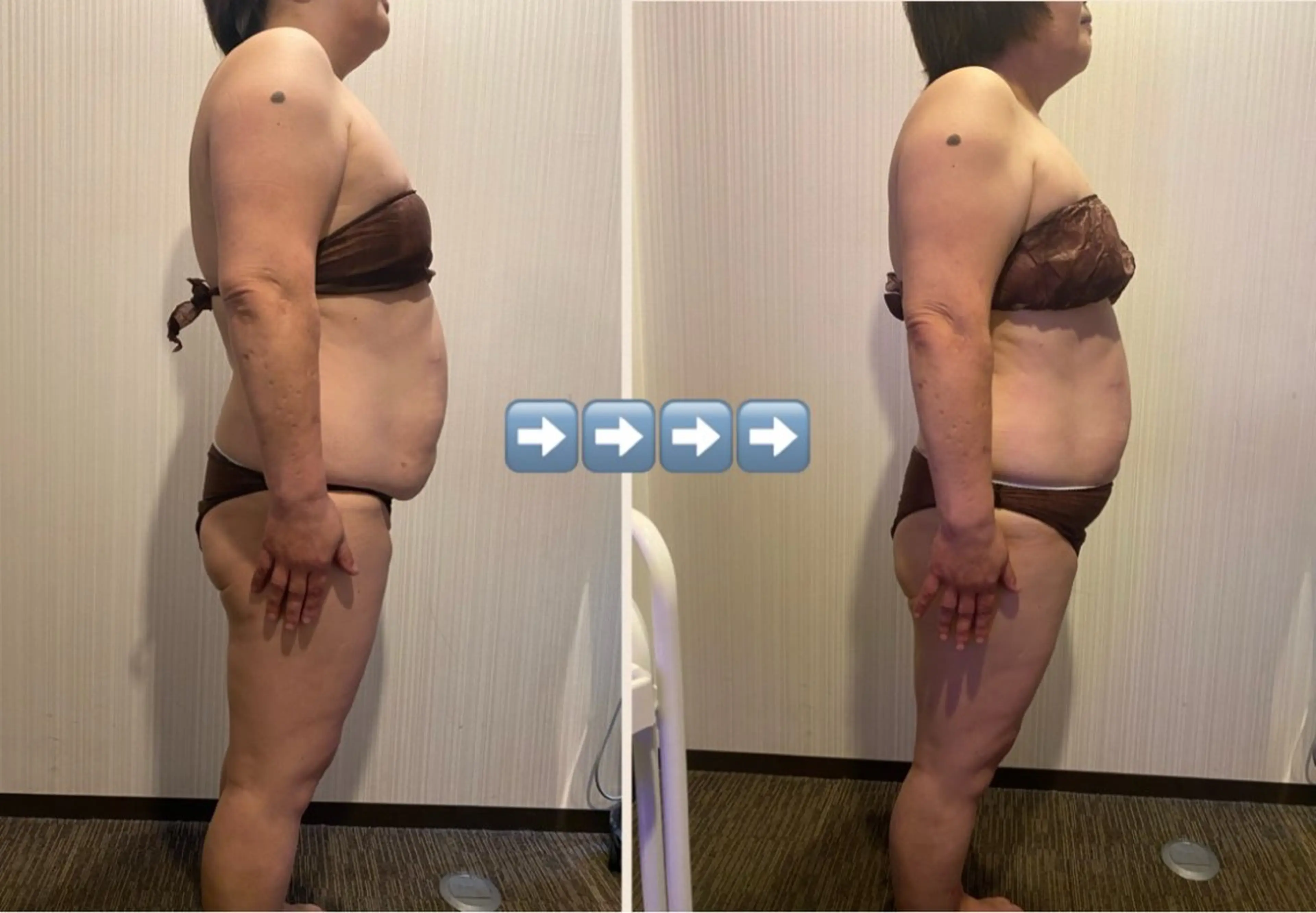 エステ Chii Salon ネイル/痩身エステのネイルデザイン