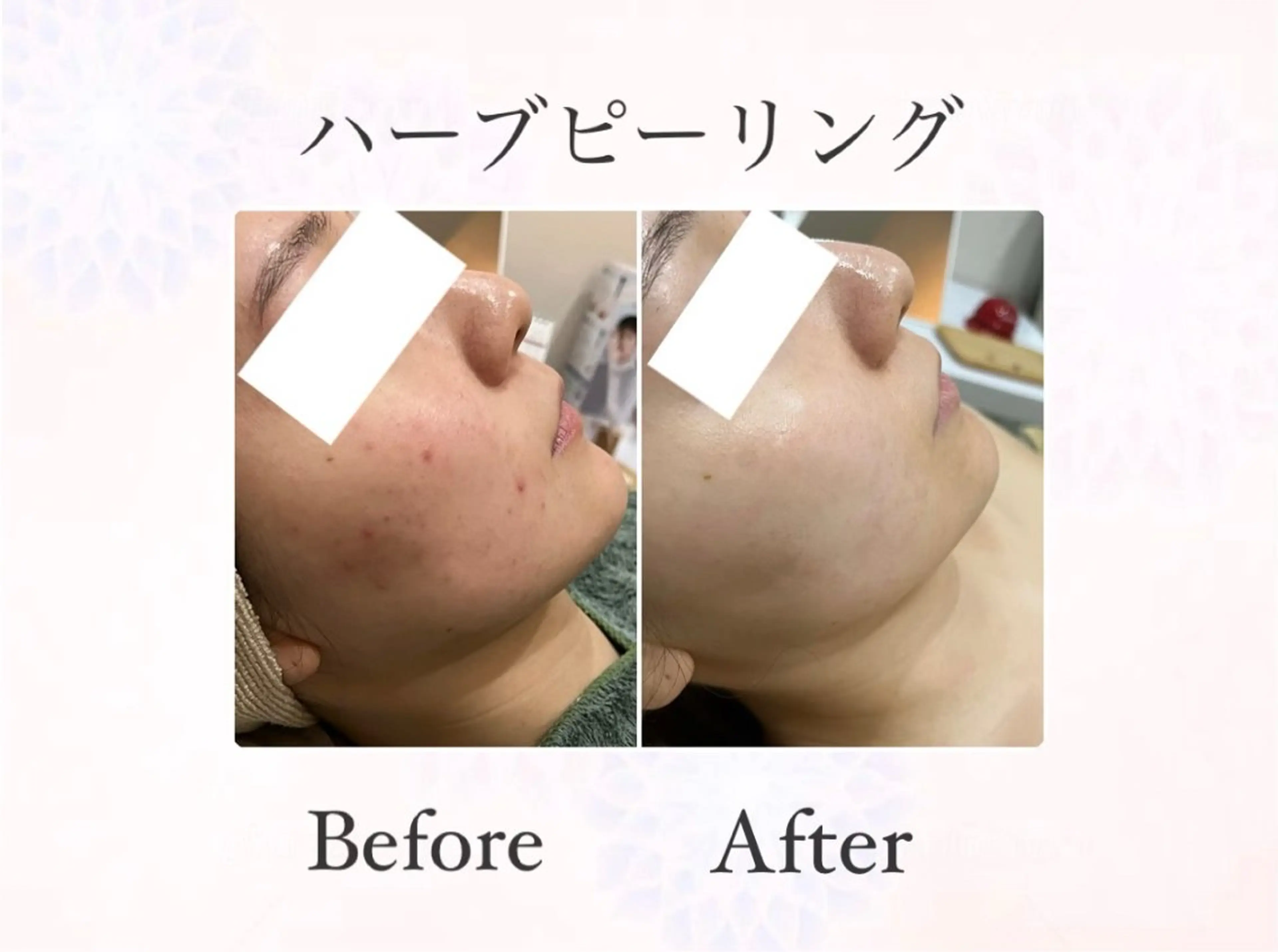 脱毛&フェイシャル 専門店muro.のエステ・リラクイメージ