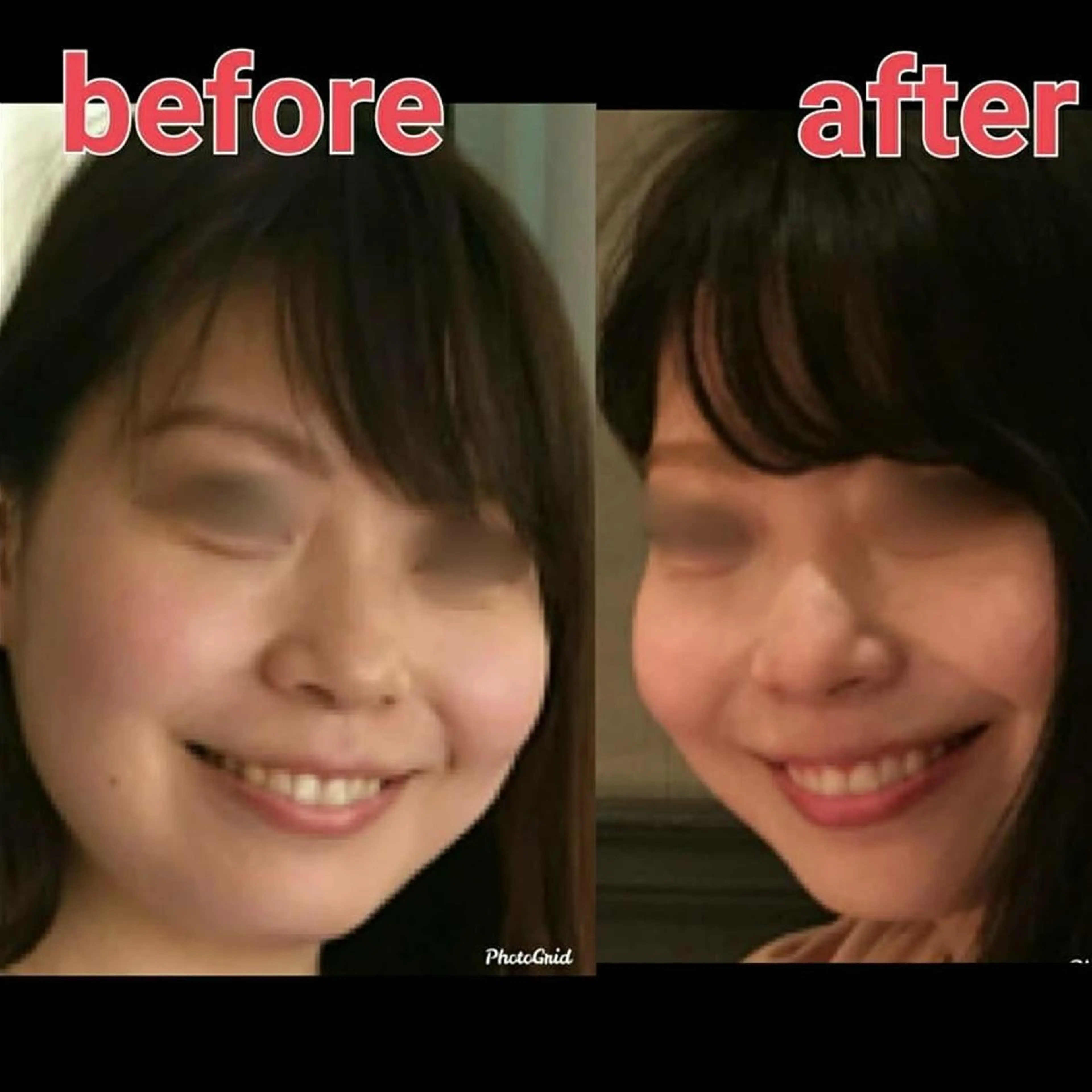超小顔！ちょい痛😣オールハンドで小顔フェイシャルコースの写真