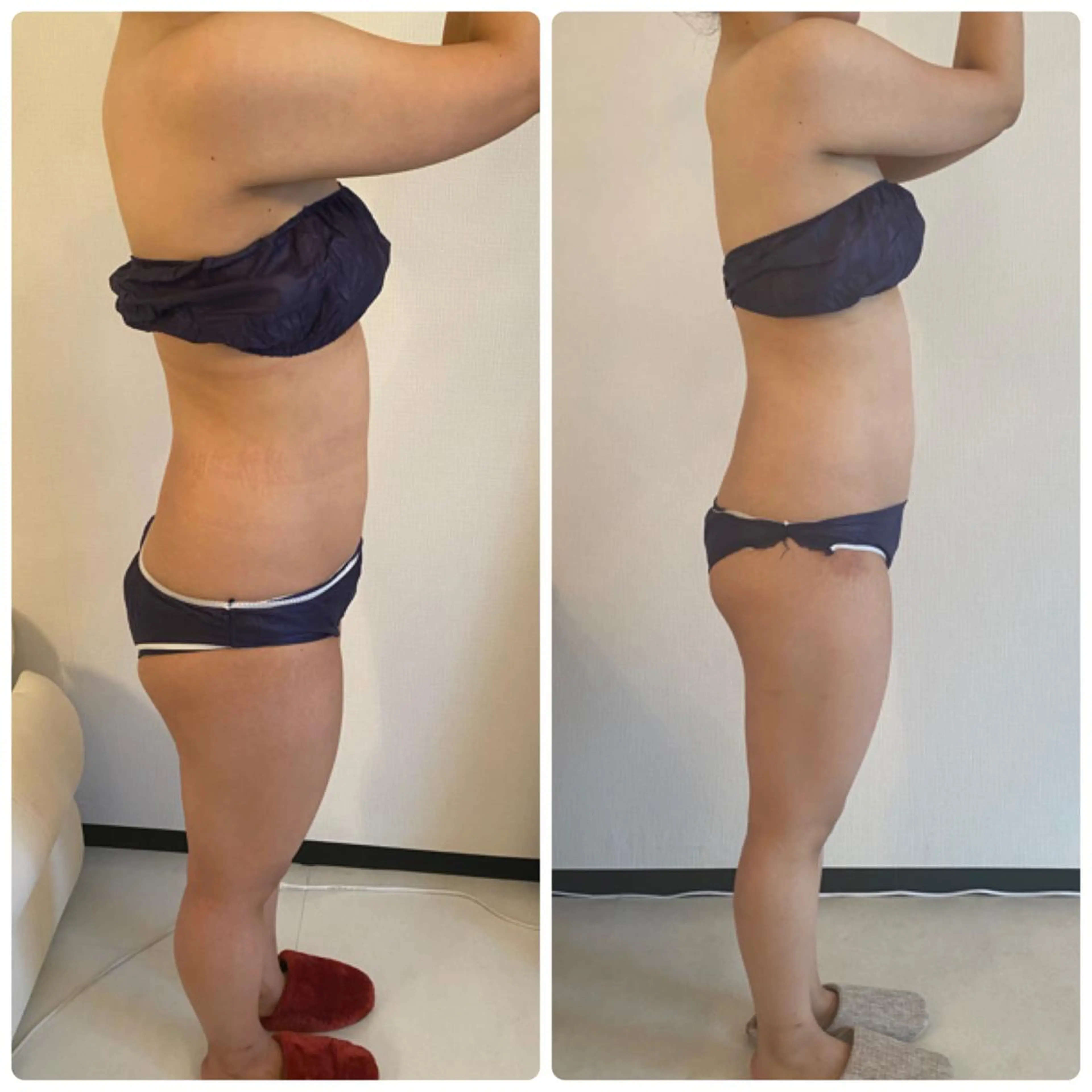 FLEUR大阪・整体 ・ハイフ・痩身・小顔のエステ・リラクイメージ